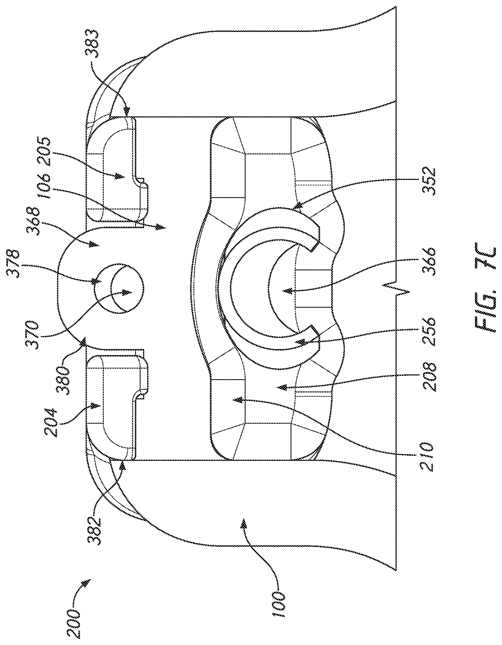 Patent US12090025 Figure 16 – Orthodontic appliance with non-sliding archform