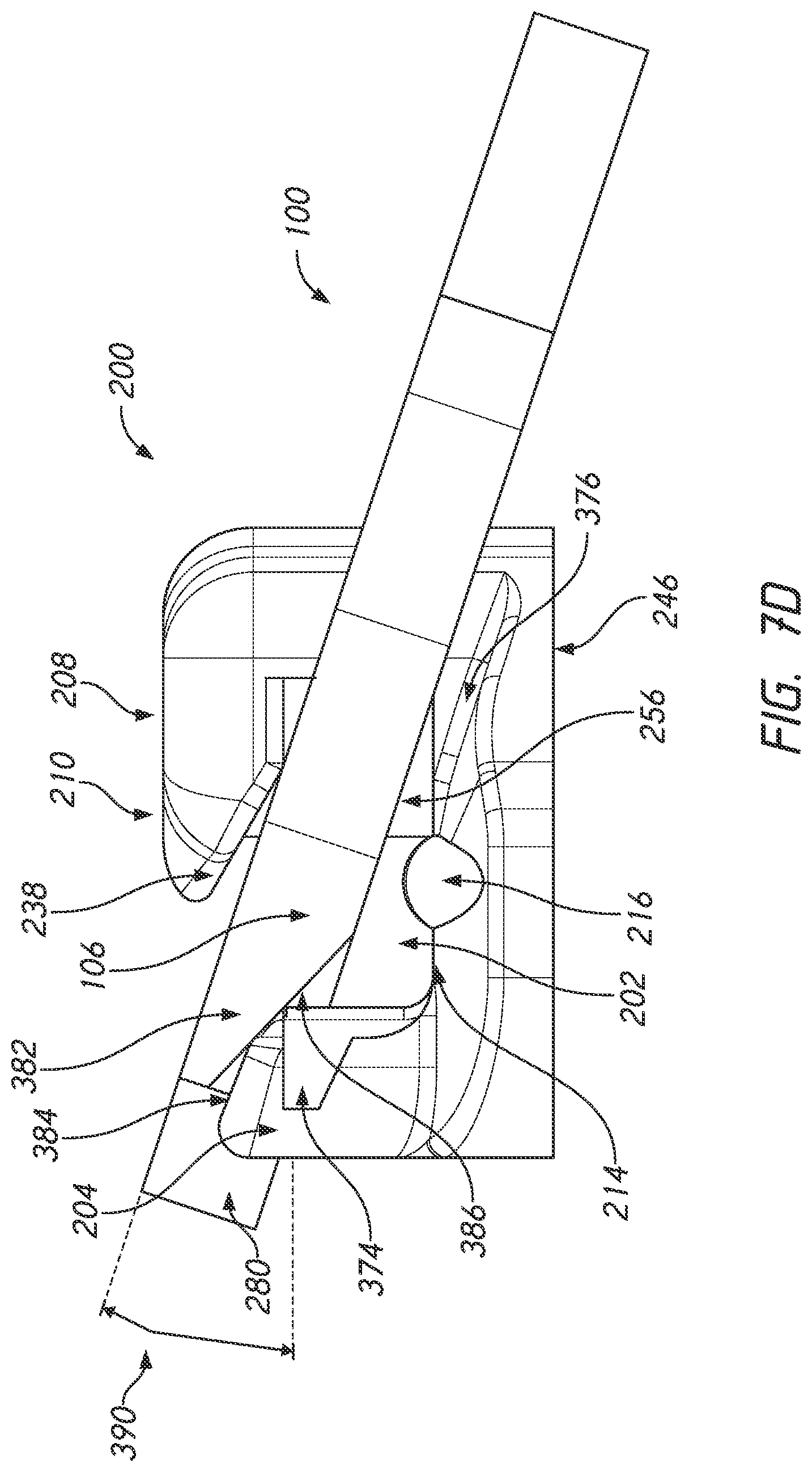 Patent US12090025 Figure 17 – Orthodontic appliance with non-sliding archform