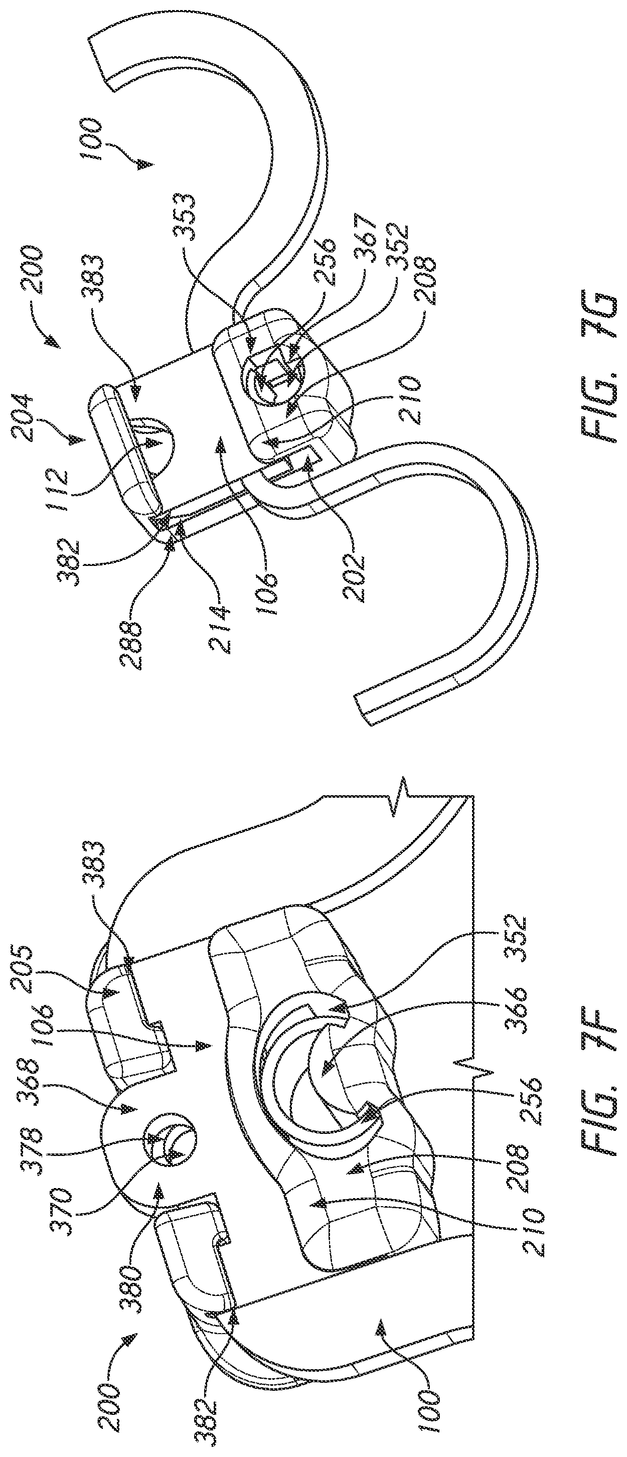 Patent US12090025 Figure 19 – Orthodontic appliance with non-sliding archform