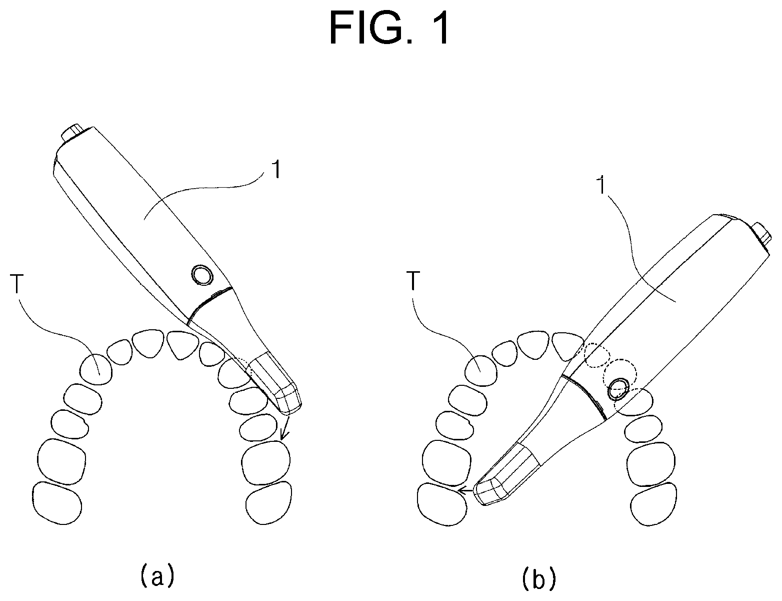 Patent US12090026 Figure 1 – Three-dimensional intraoral scanner
