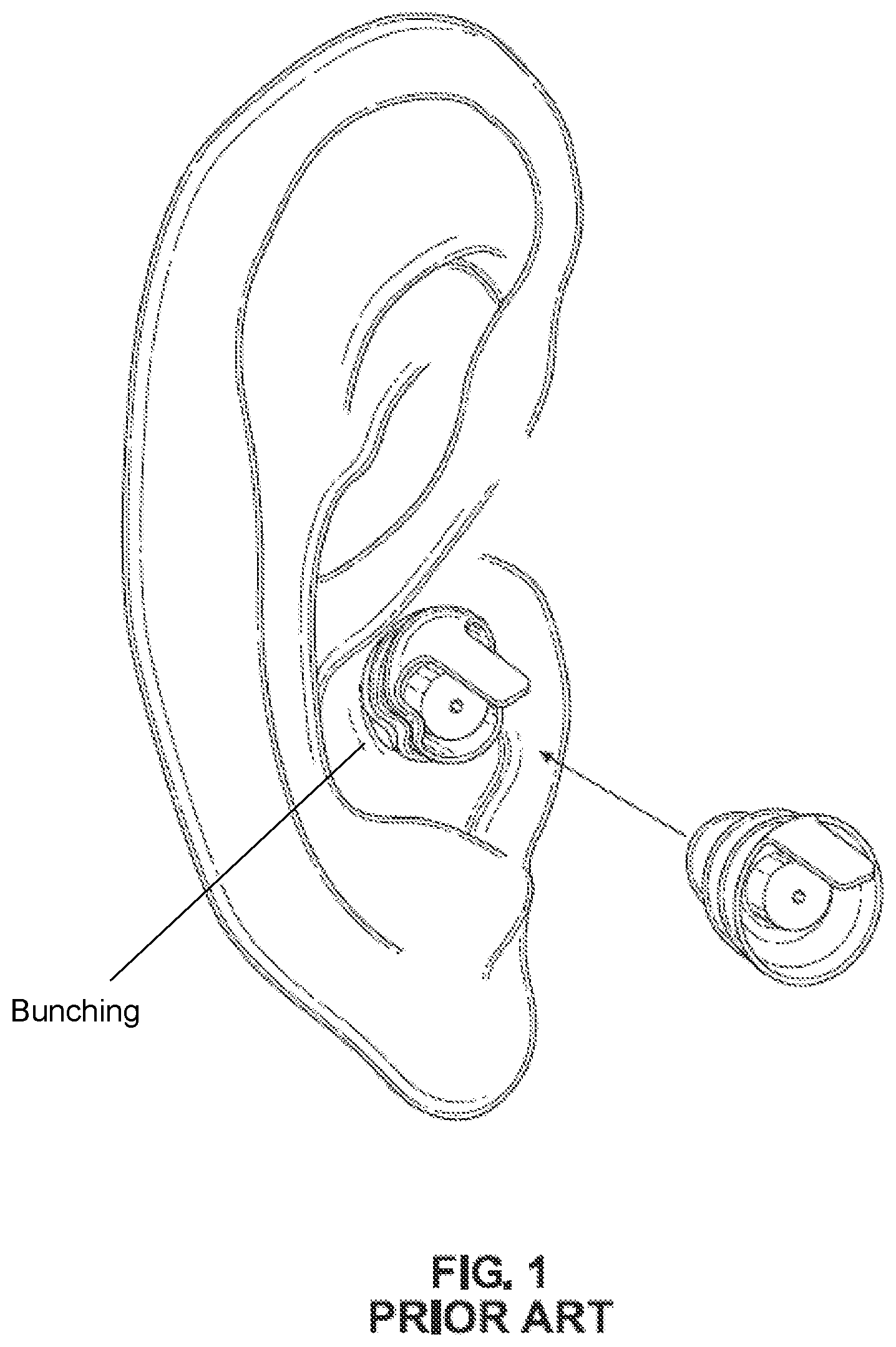 Patent US12090027 Figure 1 – Sound attenuation devices