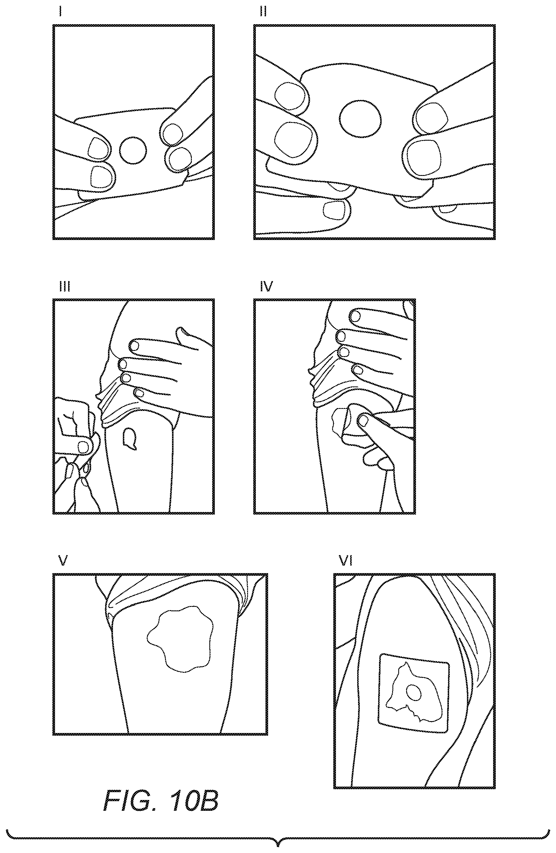 Patent US12090029 Figure 8 – Devices and methods for enhancing immunogenicity to intradermal vaccination