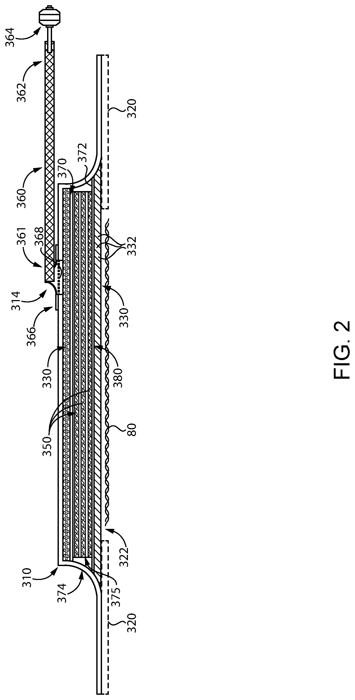 Patent US12090030 Figure 2 – Wound exudate management systems