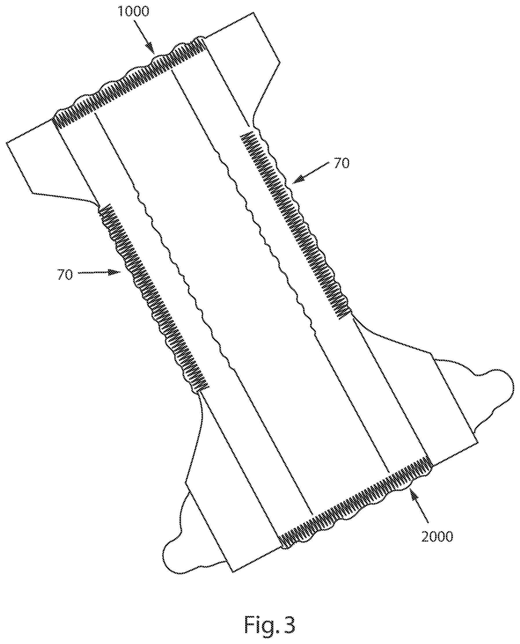 Patent US12090032 Figure 3 – Absorbent article with a waistband and leg cuffs having gathers