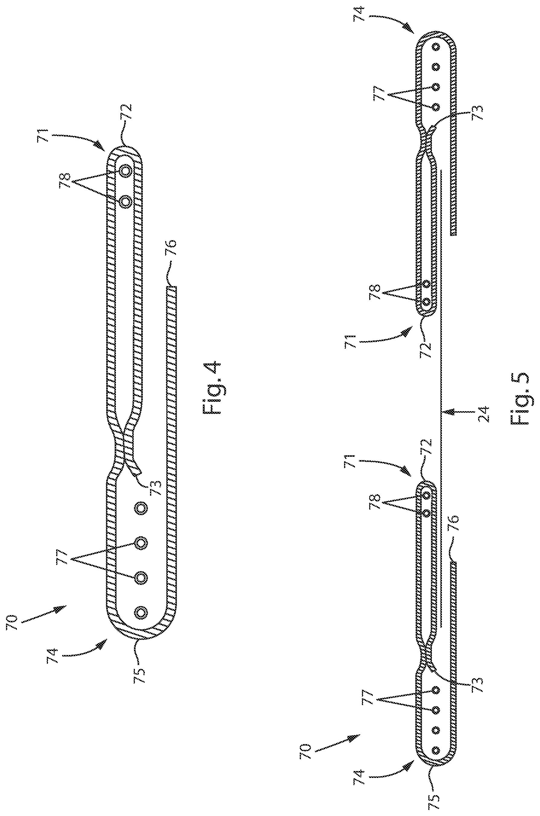 Patent US12090032 Figure 4 – Absorbent article with a waistband and leg cuffs having gathers