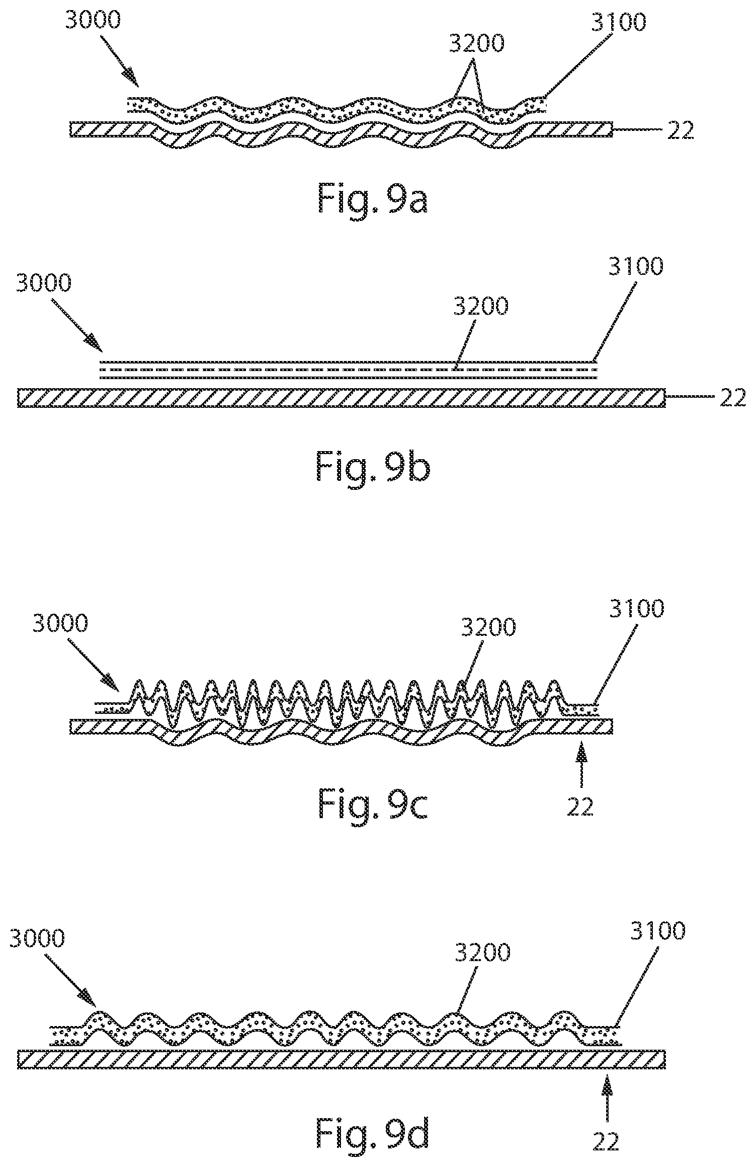 Patent US12090032 Figure 7 – Absorbent article with a waistband and leg cuffs having gathers