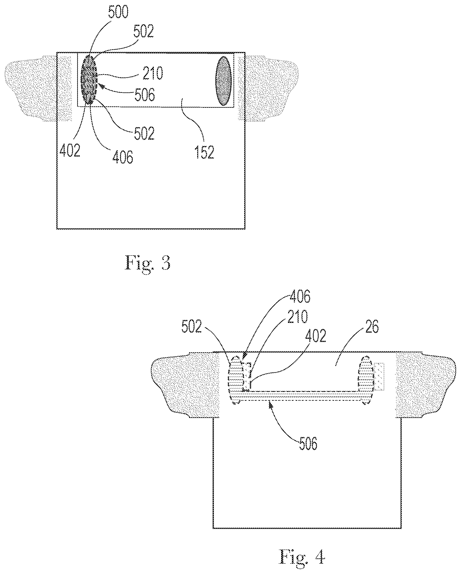 Patent US12090035 Figure 3 – Absorbent article having fastening system