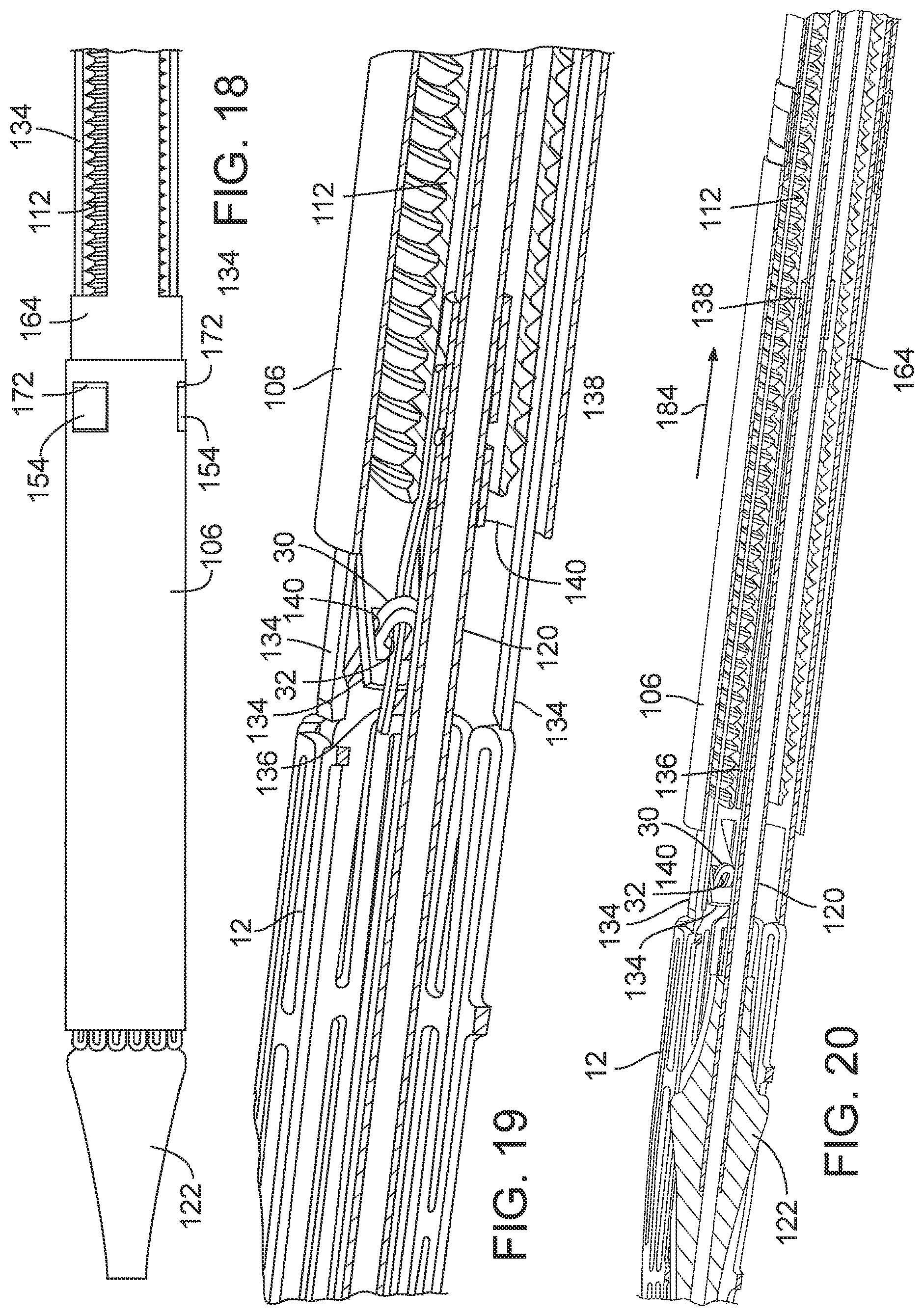 Patent US12090036 Figure 11 – Storage assembly for prosthetic valve