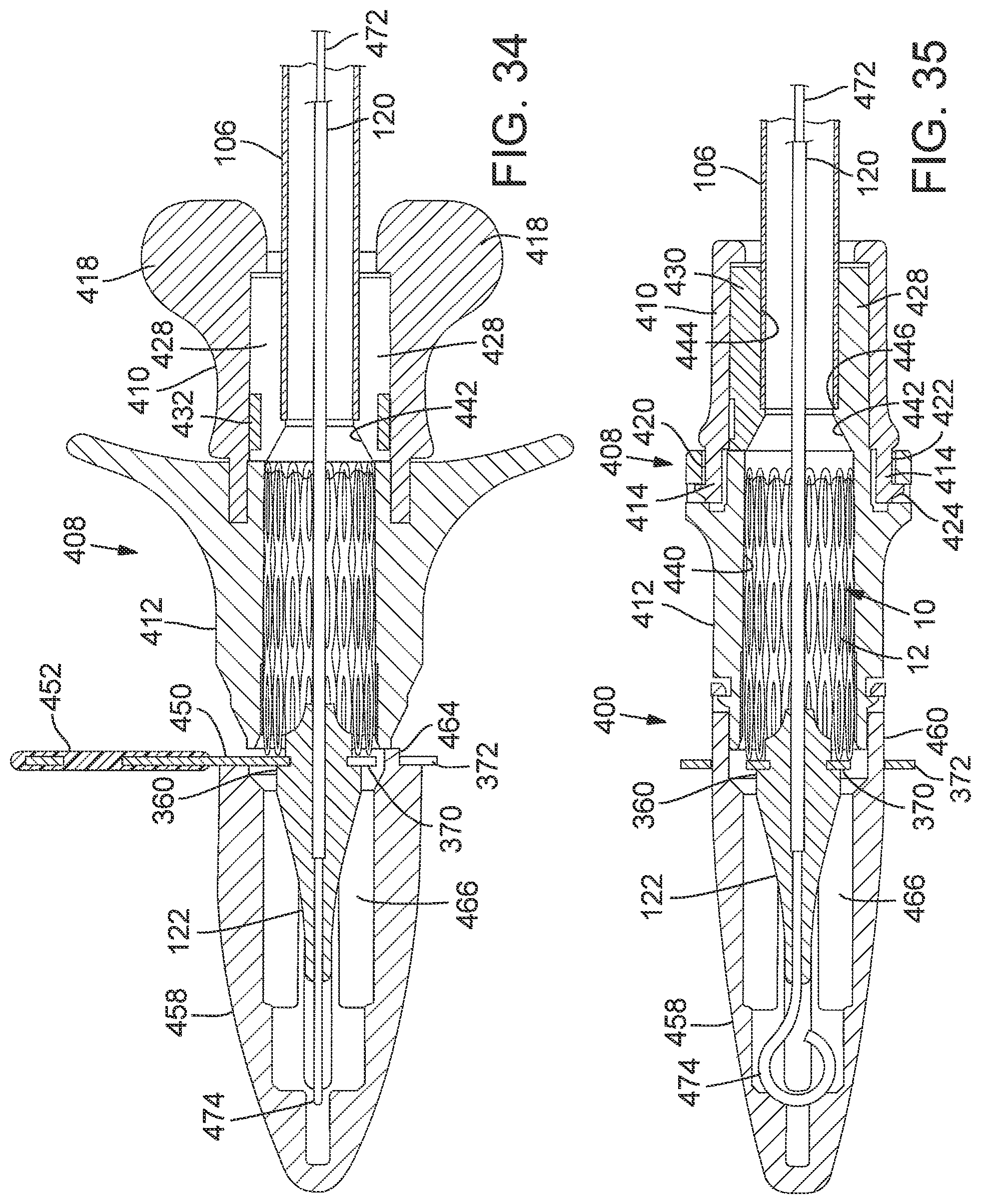 Patent US12090036 Figure 19 – Storage assembly for prosthetic valve