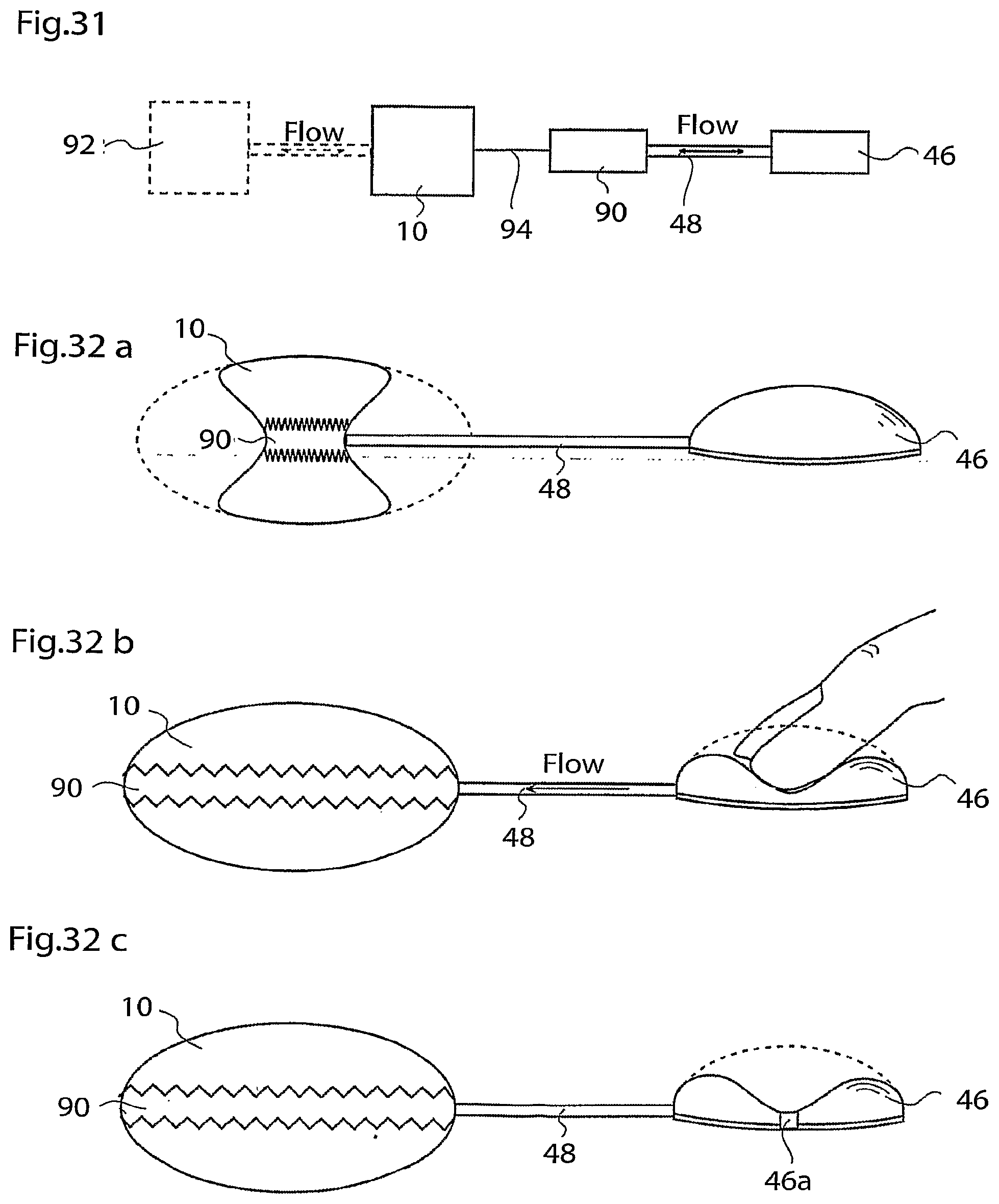 Patent US12090037 Figure 15 – Apparatus for treating obesity and reflux disease