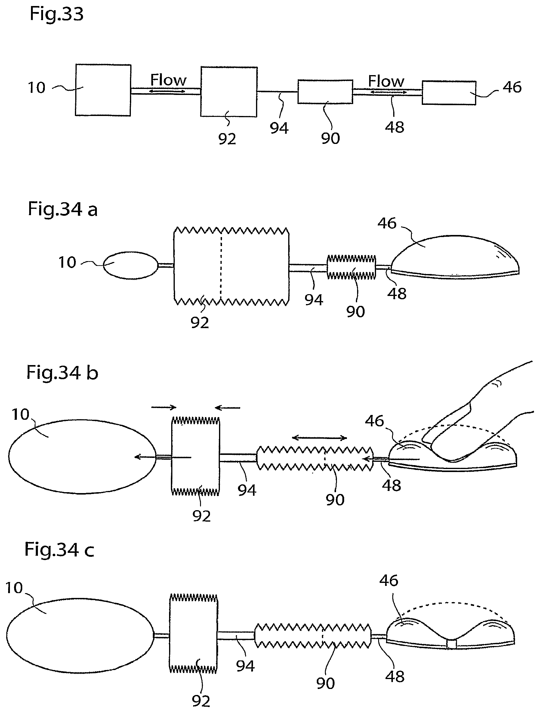 Patent US12090037 Figure 16 – Apparatus for treating obesity and reflux disease