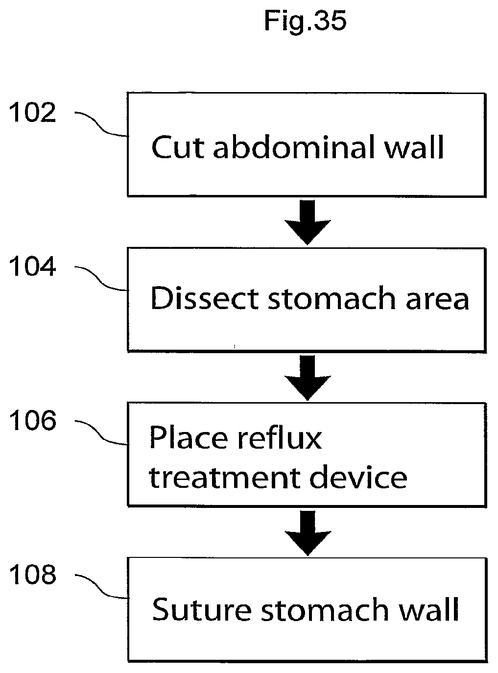 Patent US12090037 Figure 17 – Apparatus for treating obesity and reflux disease