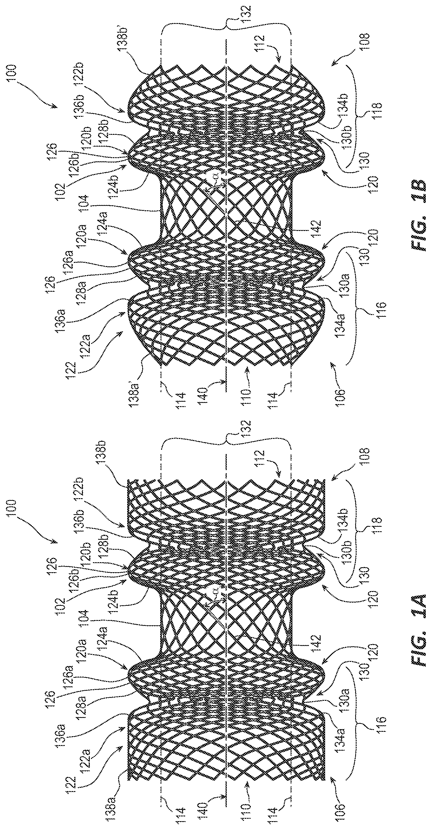 Patent US12090038 Figure 1 – Esophageal stents and related methods
