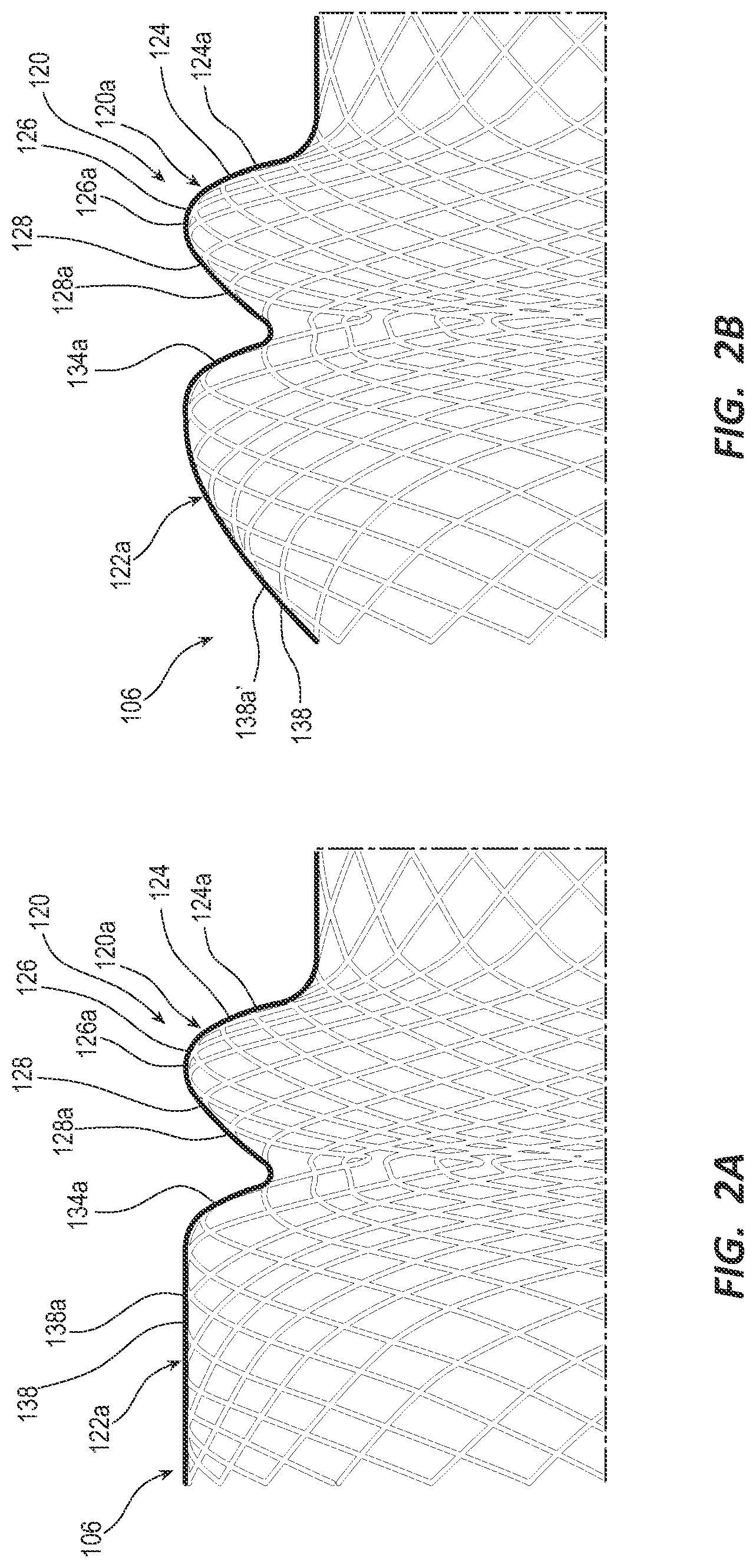 Patent US12090038 Figure 2 – Esophageal stents and related methods