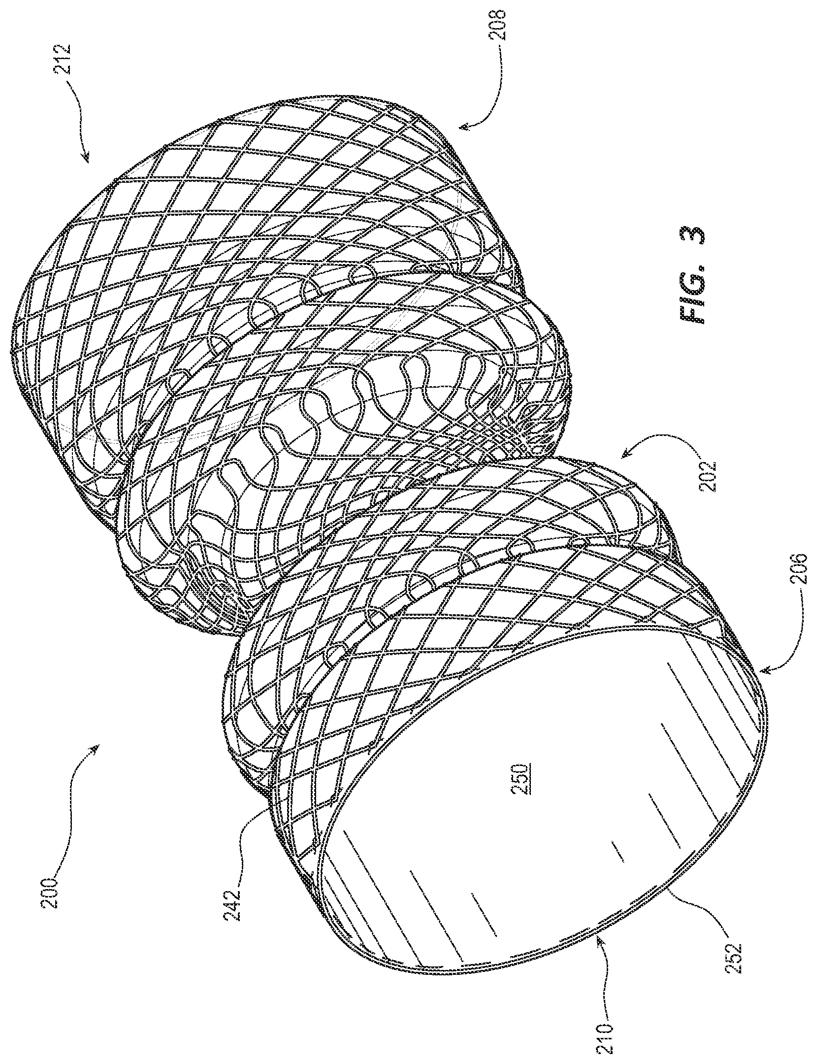 Patent US12090038 Figure 3 – Esophageal stents and related methods