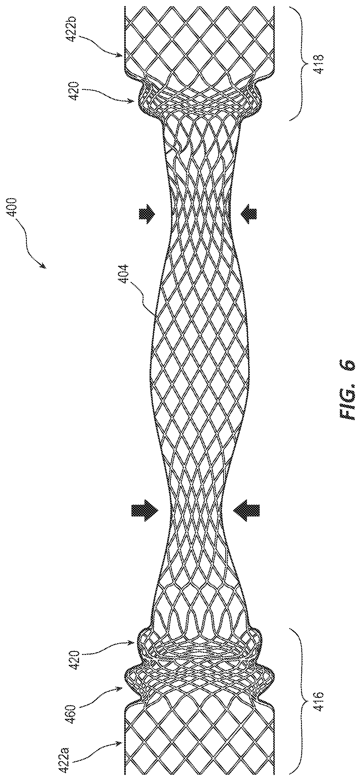 Patent US12090038 Figure 6 – Esophageal stents and related methods