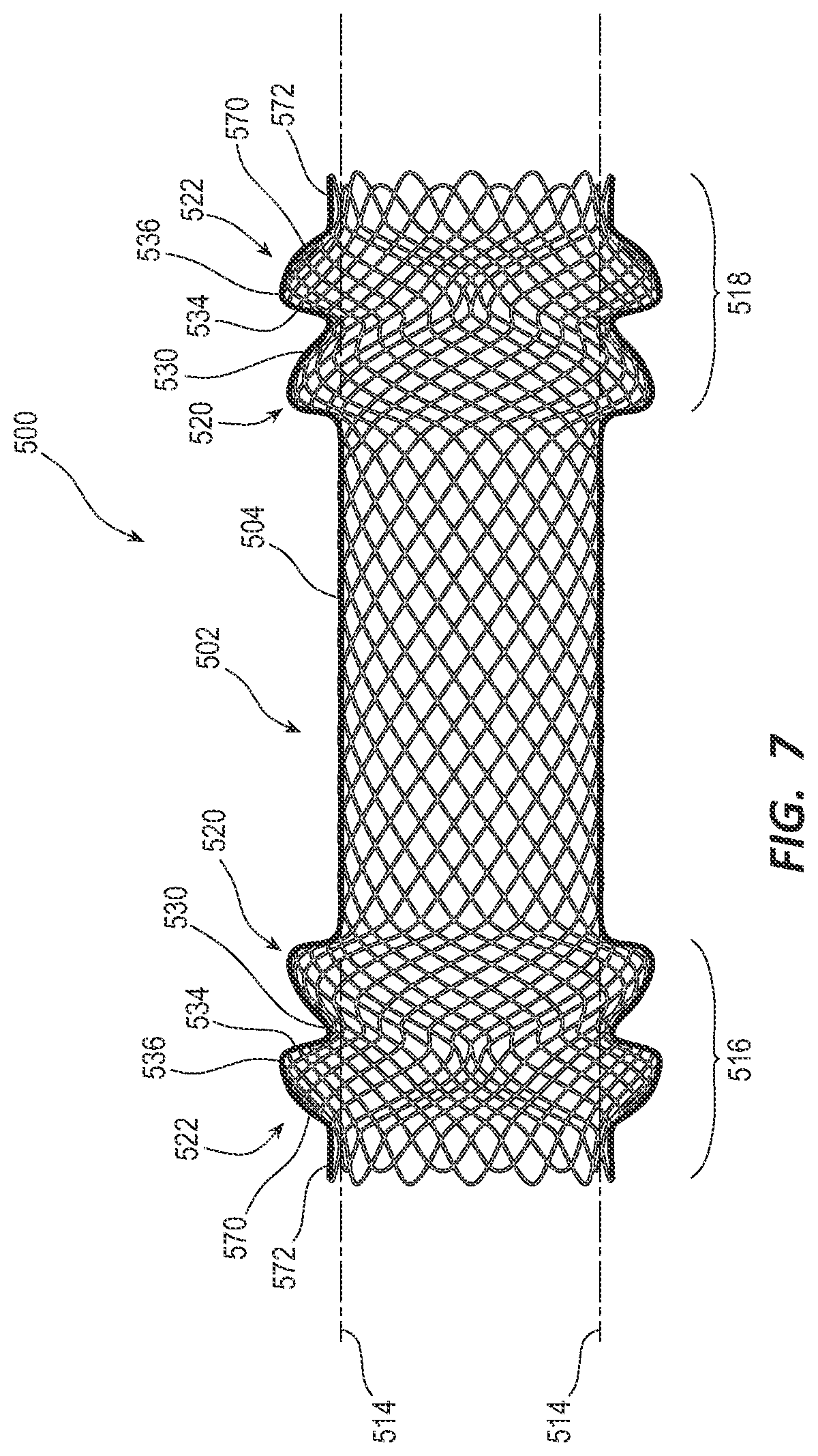 Patent US12090038 Figure 7 – Esophageal stents and related methods