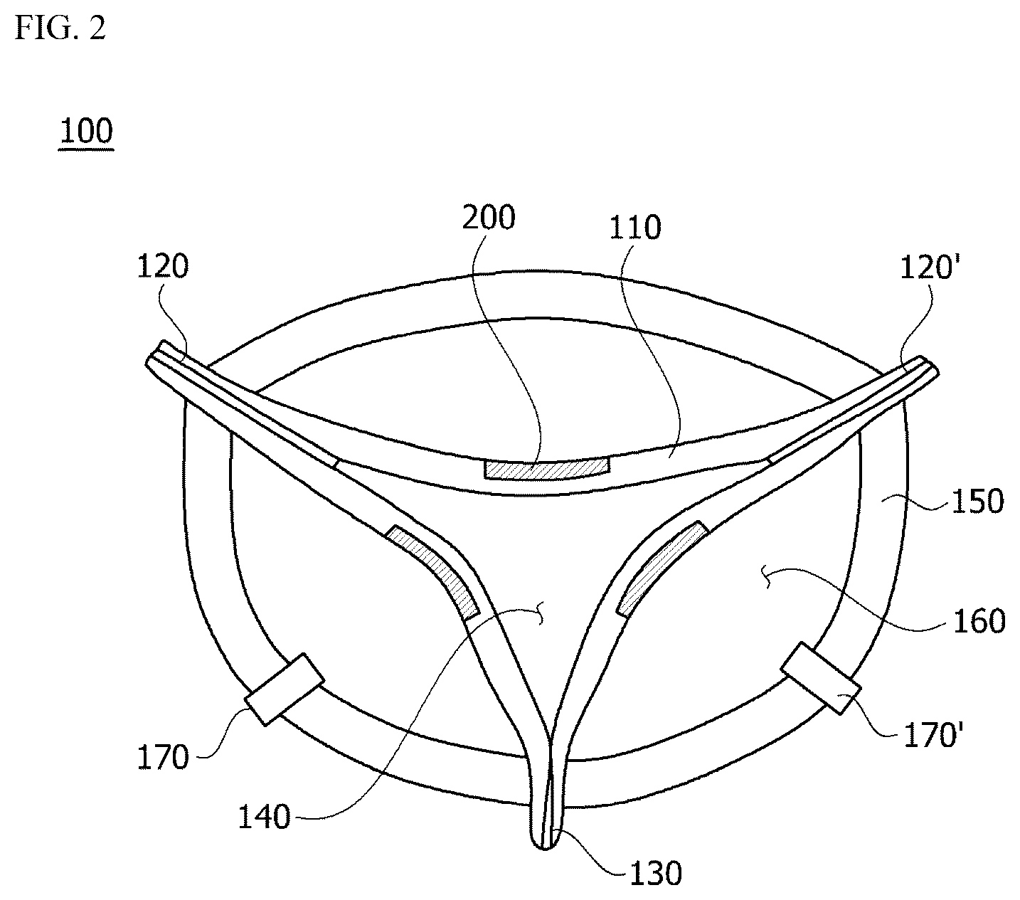 Patent US12090039 Figure 2 – Biomimetic artificial bladder and method for controlling same