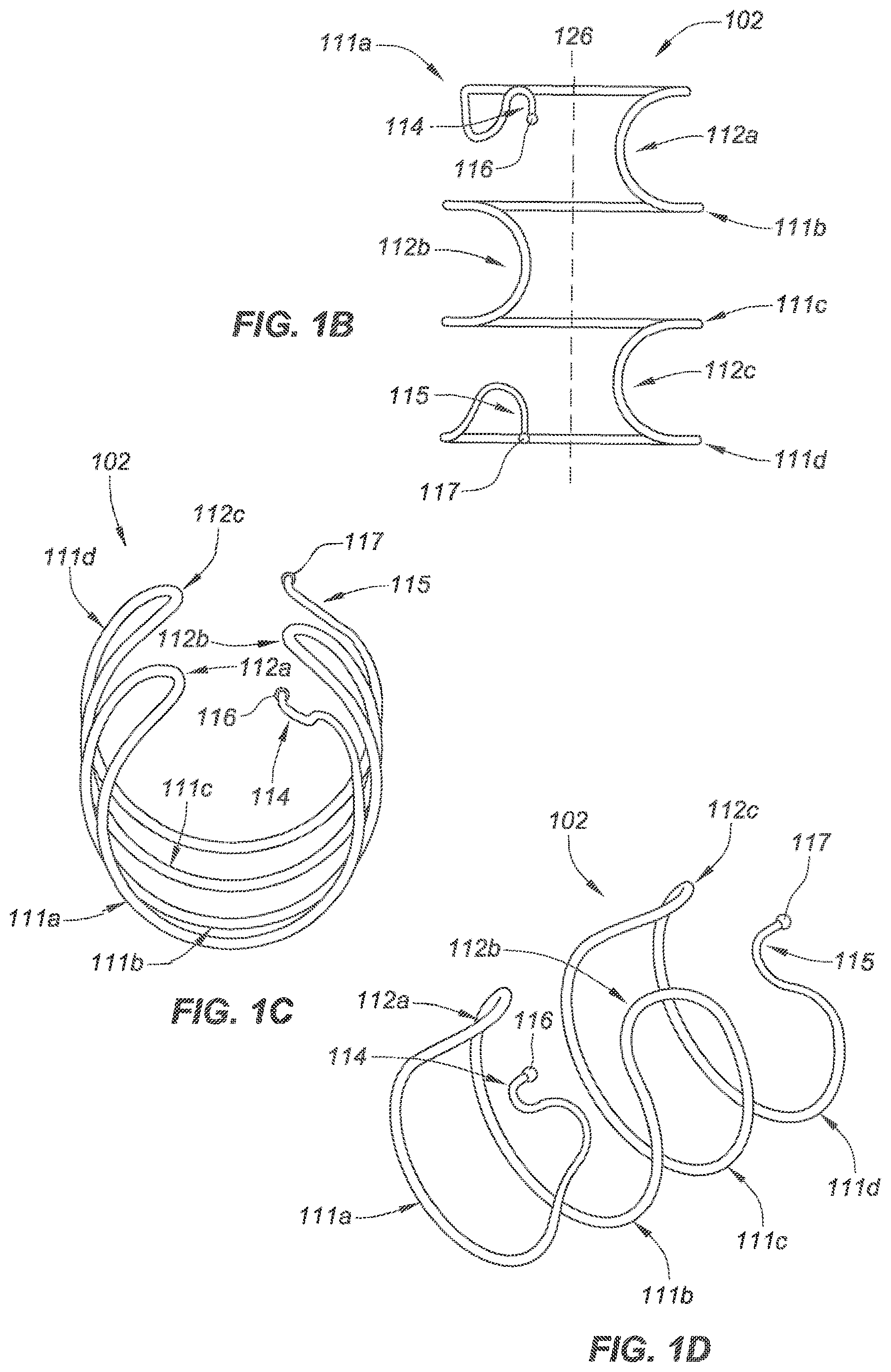 Patent US12090040 Figure 2 – Methods for deployment of an implant