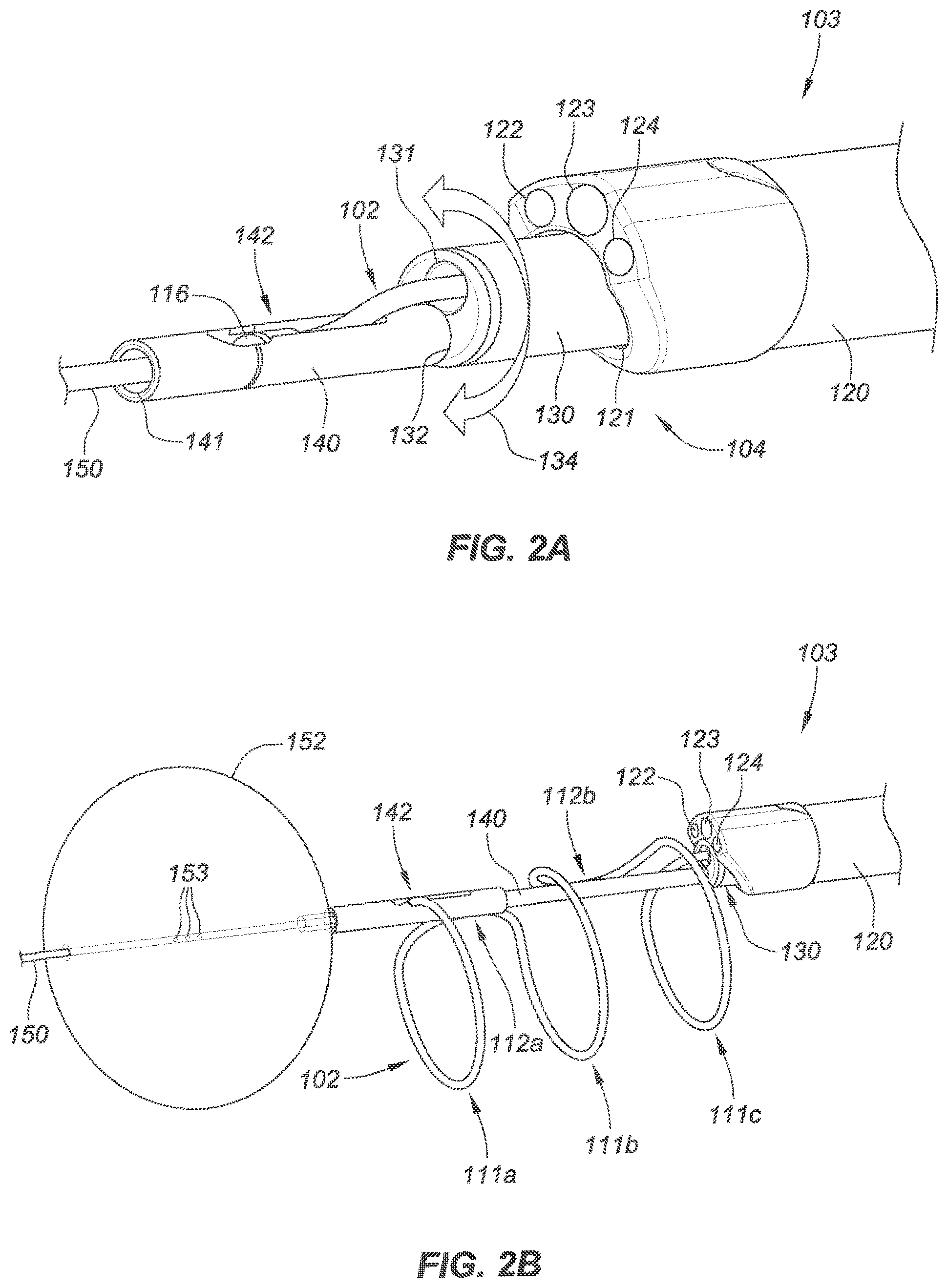 Patent US12090040 Figure 3 – Methods for deployment of an implant