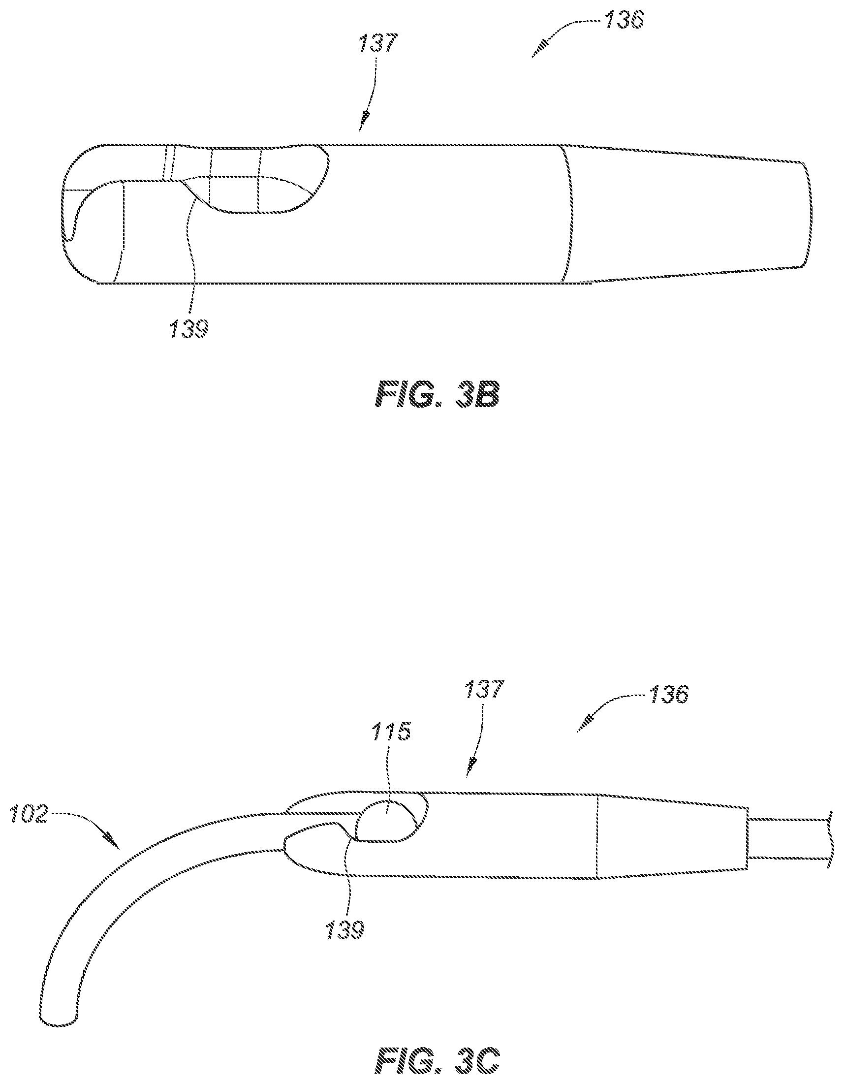 Patent US12090040 Figure 8 – Methods for deployment of an implant