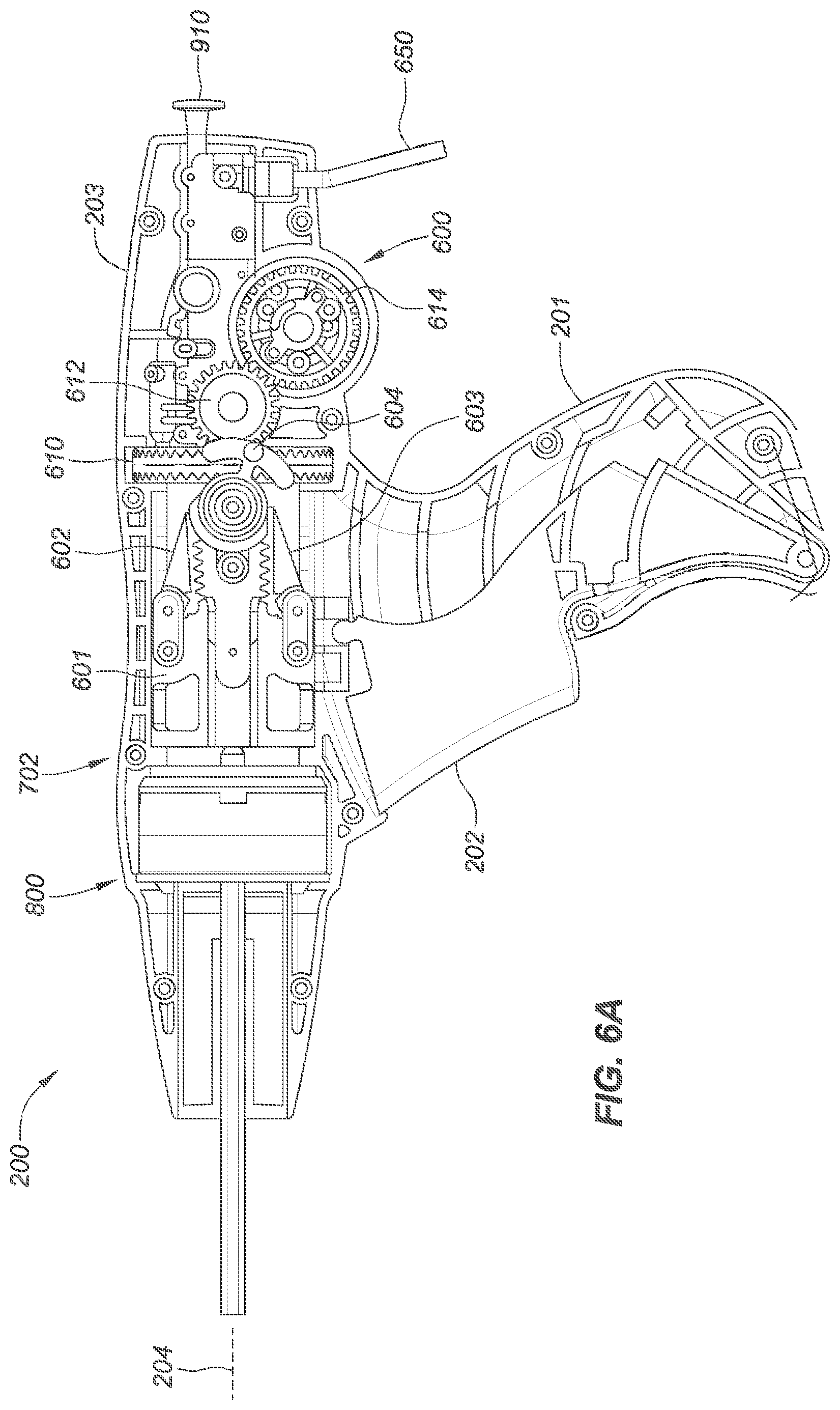 Patent US12090040 Figure 15 – Methods for deployment of an implant