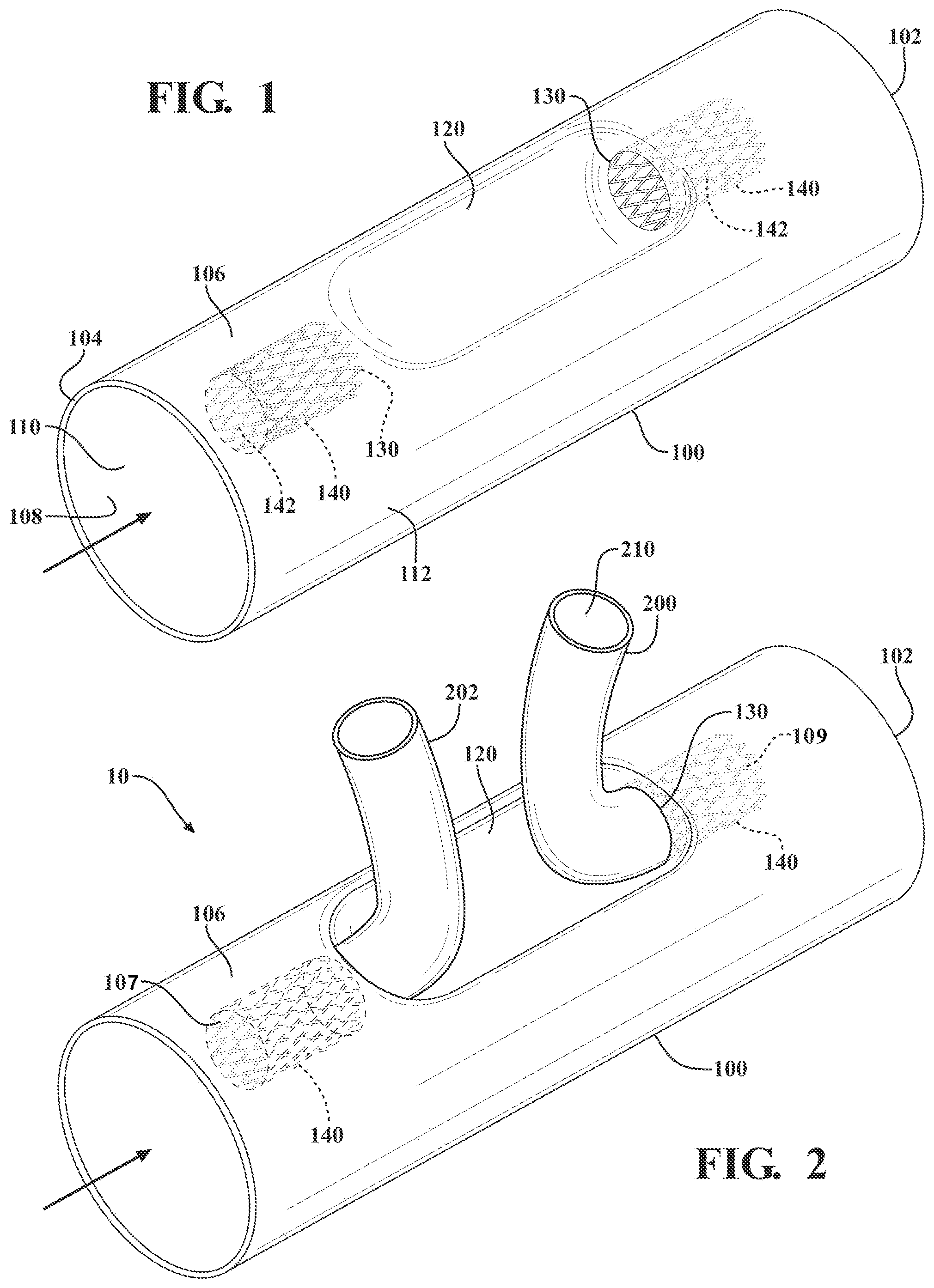Patent US12090041 Figure 1 – Branched stent graft device and deployment