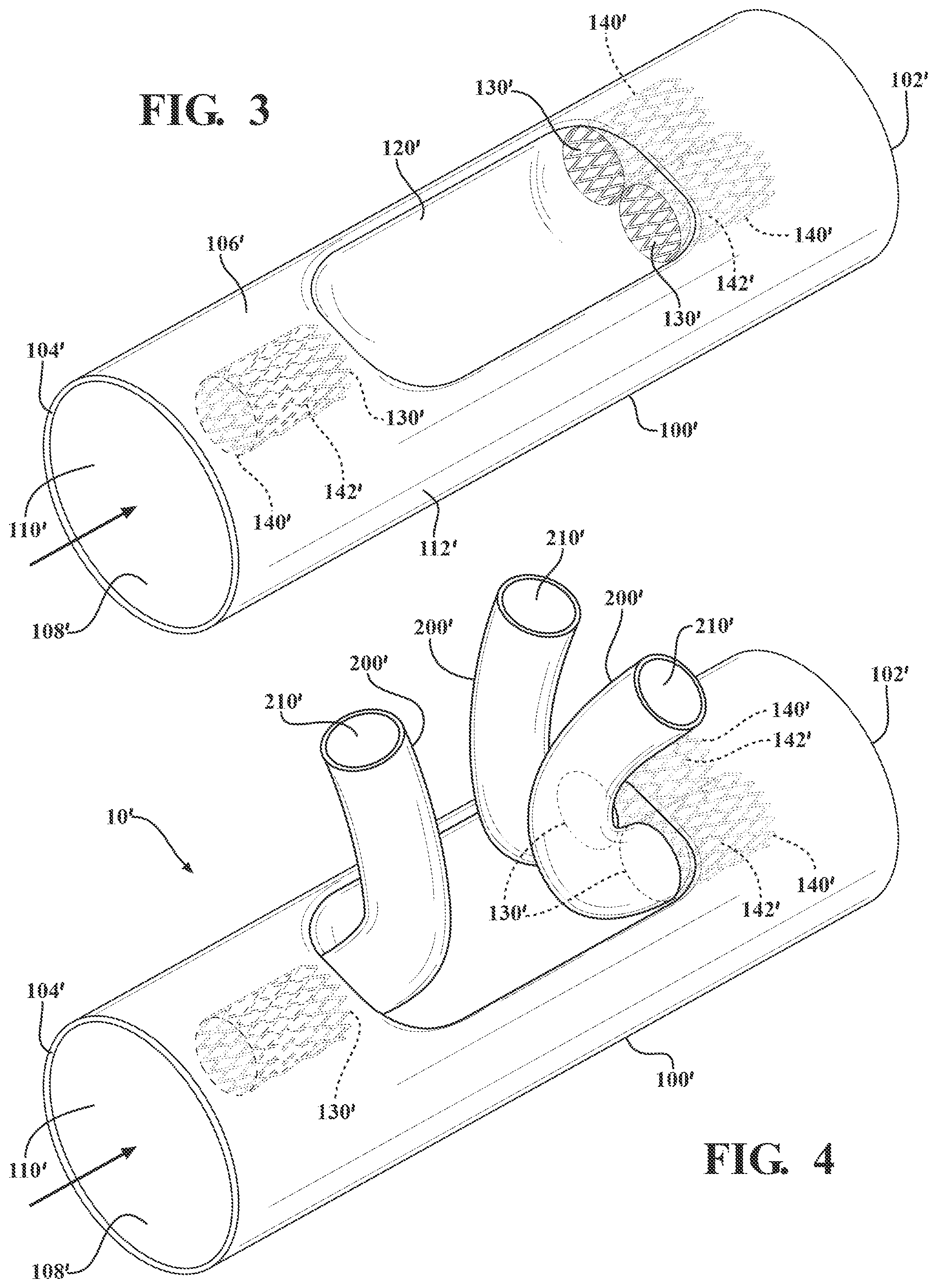 Patent US12090041 Figure 2 – Branched stent graft device and deployment