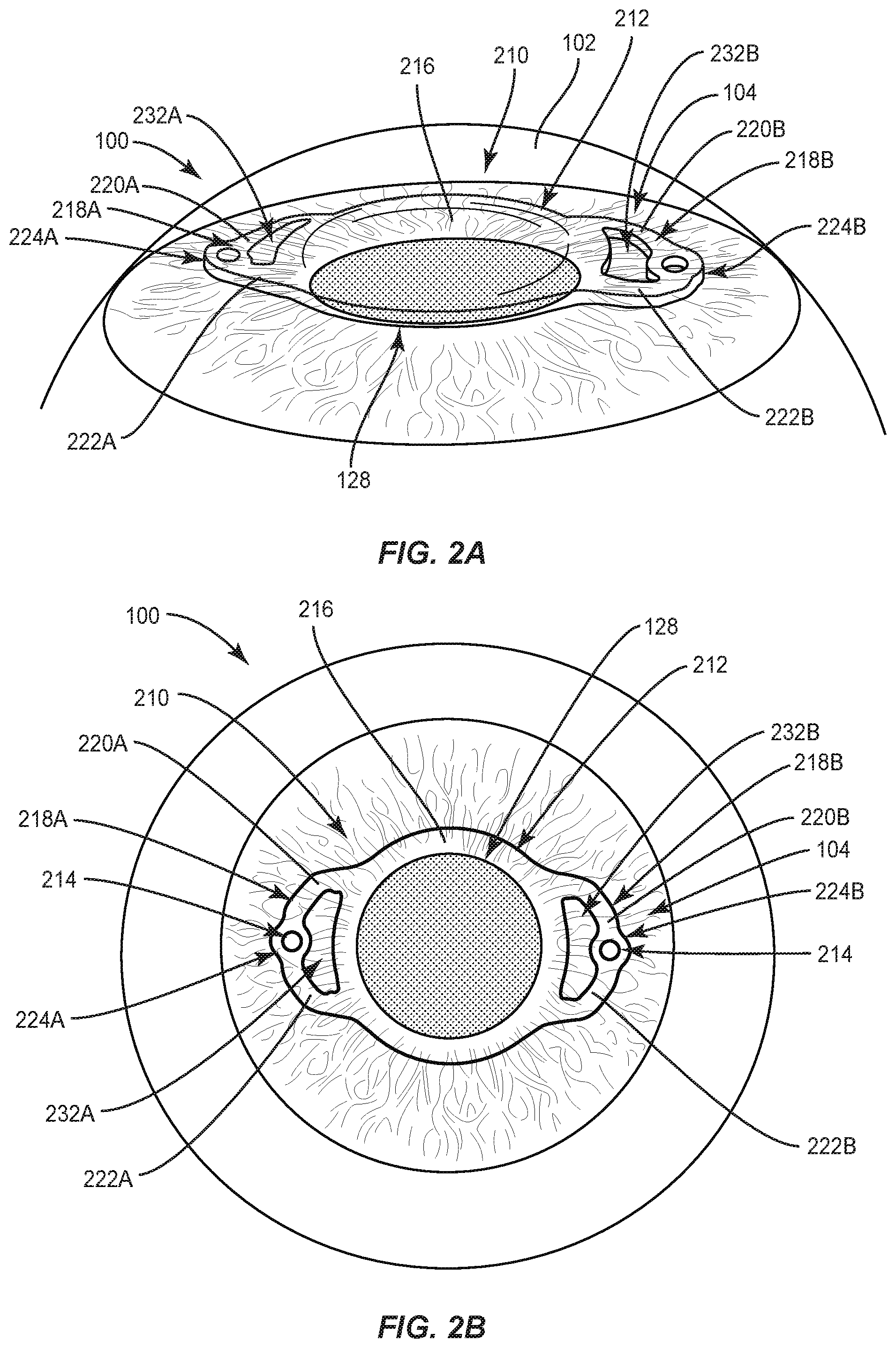 Patent US12090042 Figure 2 – Intraocular lenses (IOLs) and related assemblies and intraocular attachment methods