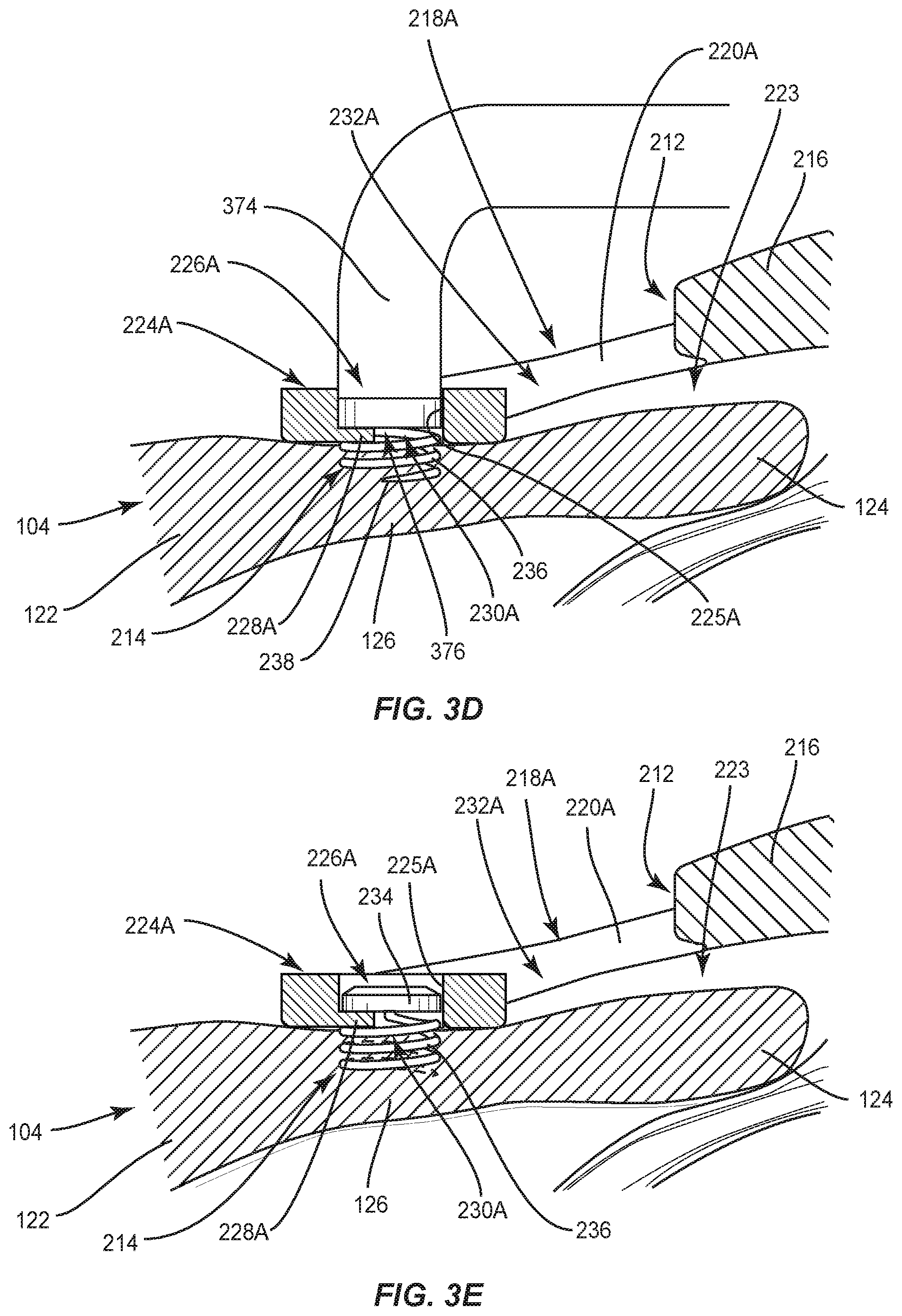 Patent US12090042 Figure 7 – Intraocular lenses (IOLs) and related assemblies and intraocular attachment methods