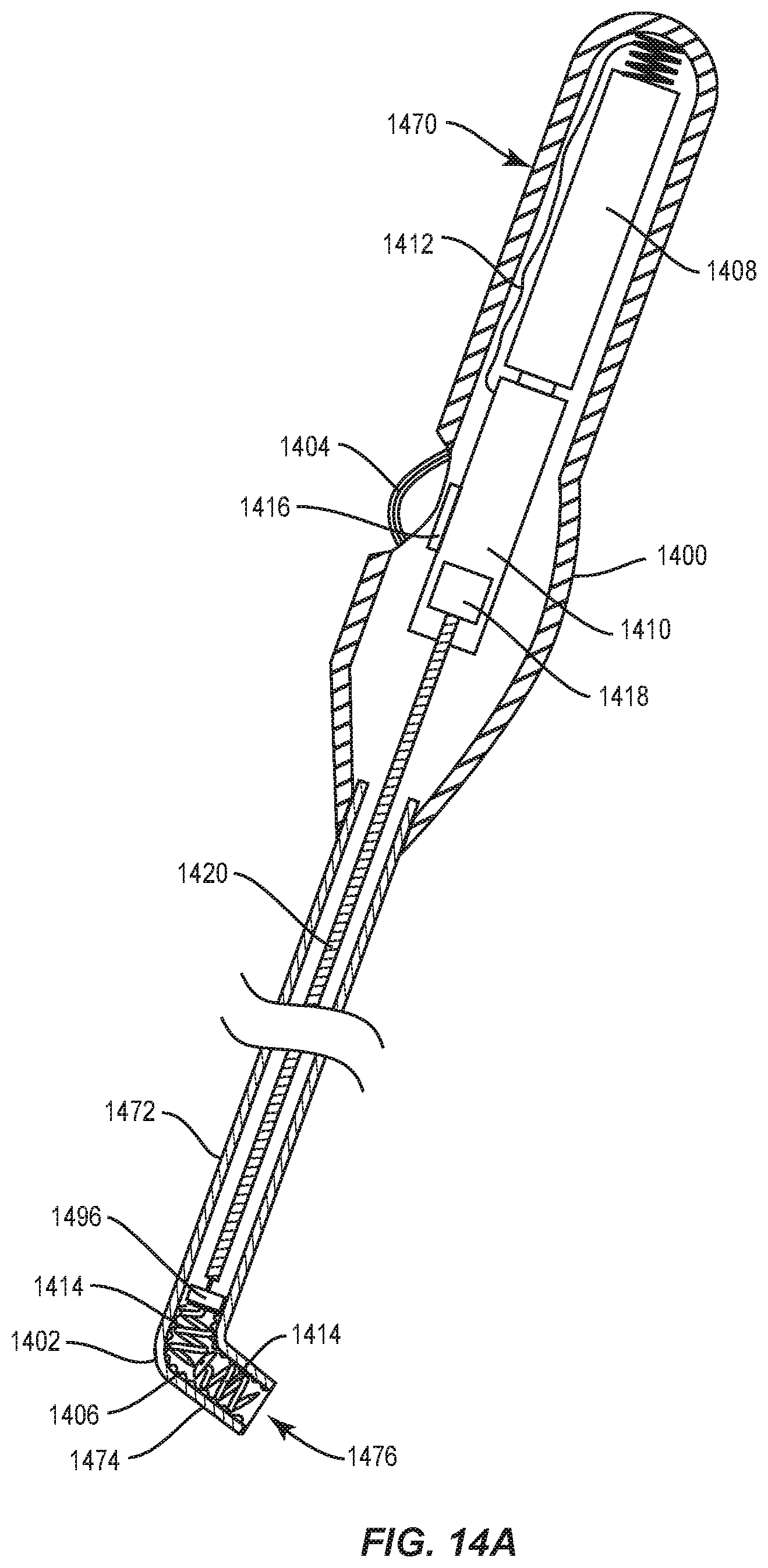 Patent US12090042 Figure 15 – Intraocular lenses (IOLs) and related assemblies and intraocular attachment methods