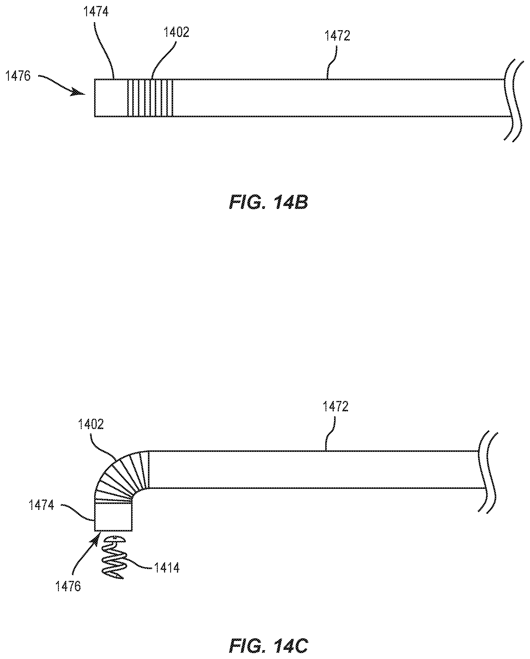Patent US12090042 Figure 16 – Intraocular lenses (IOLs) and related assemblies and intraocular attachment methods