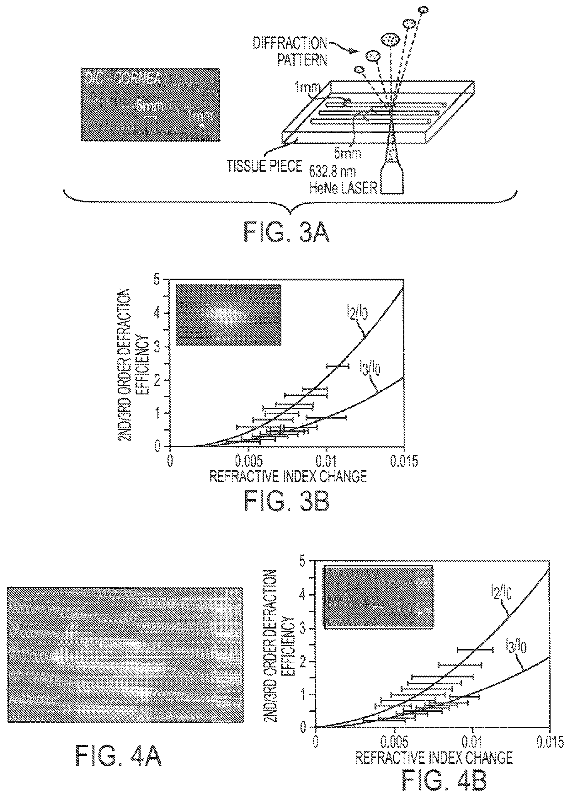 Patent US12090043 Figure 2 – Vision correction with laser refractive index changes