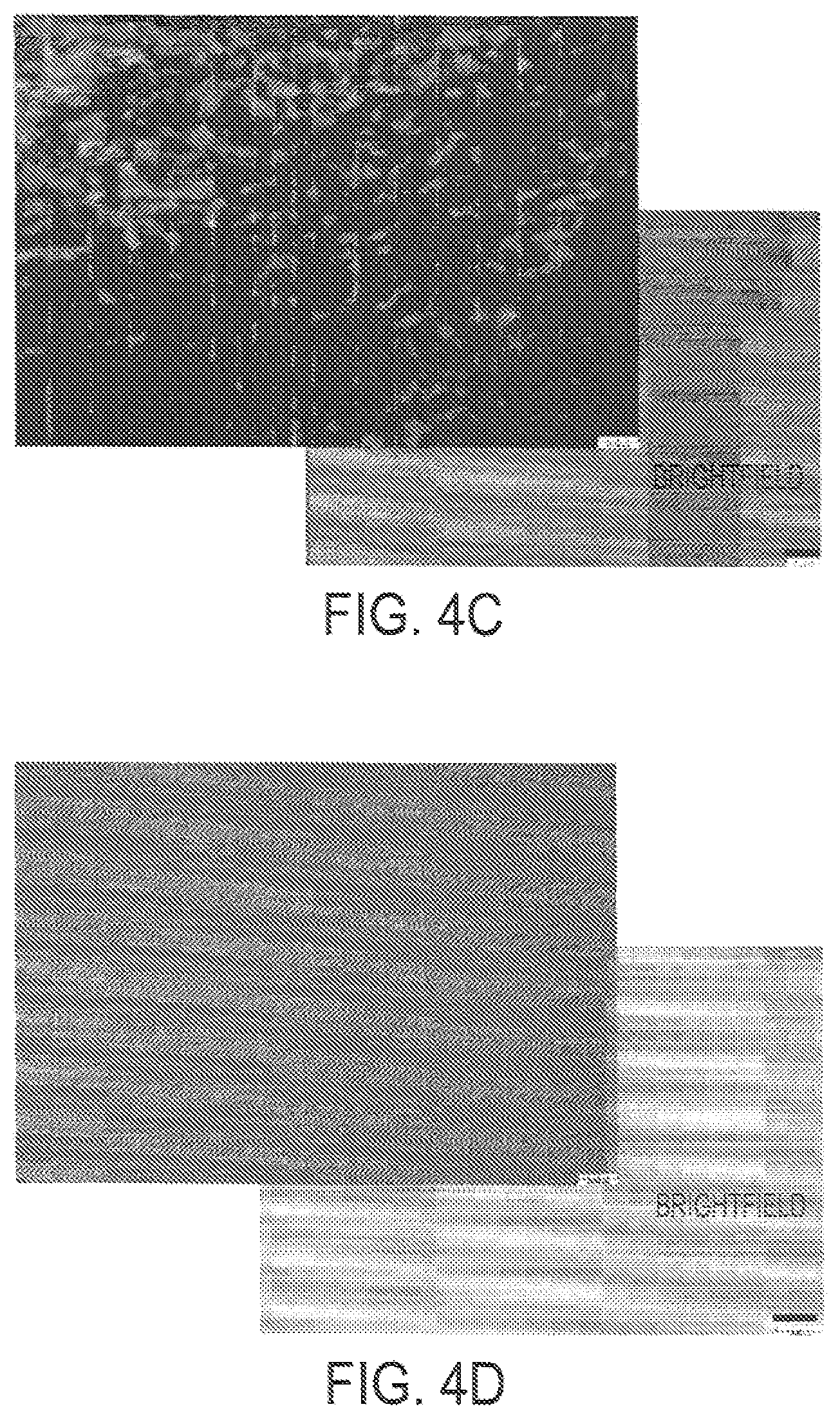Patent US12090043 Figure 3 – Vision correction with laser refractive index changes