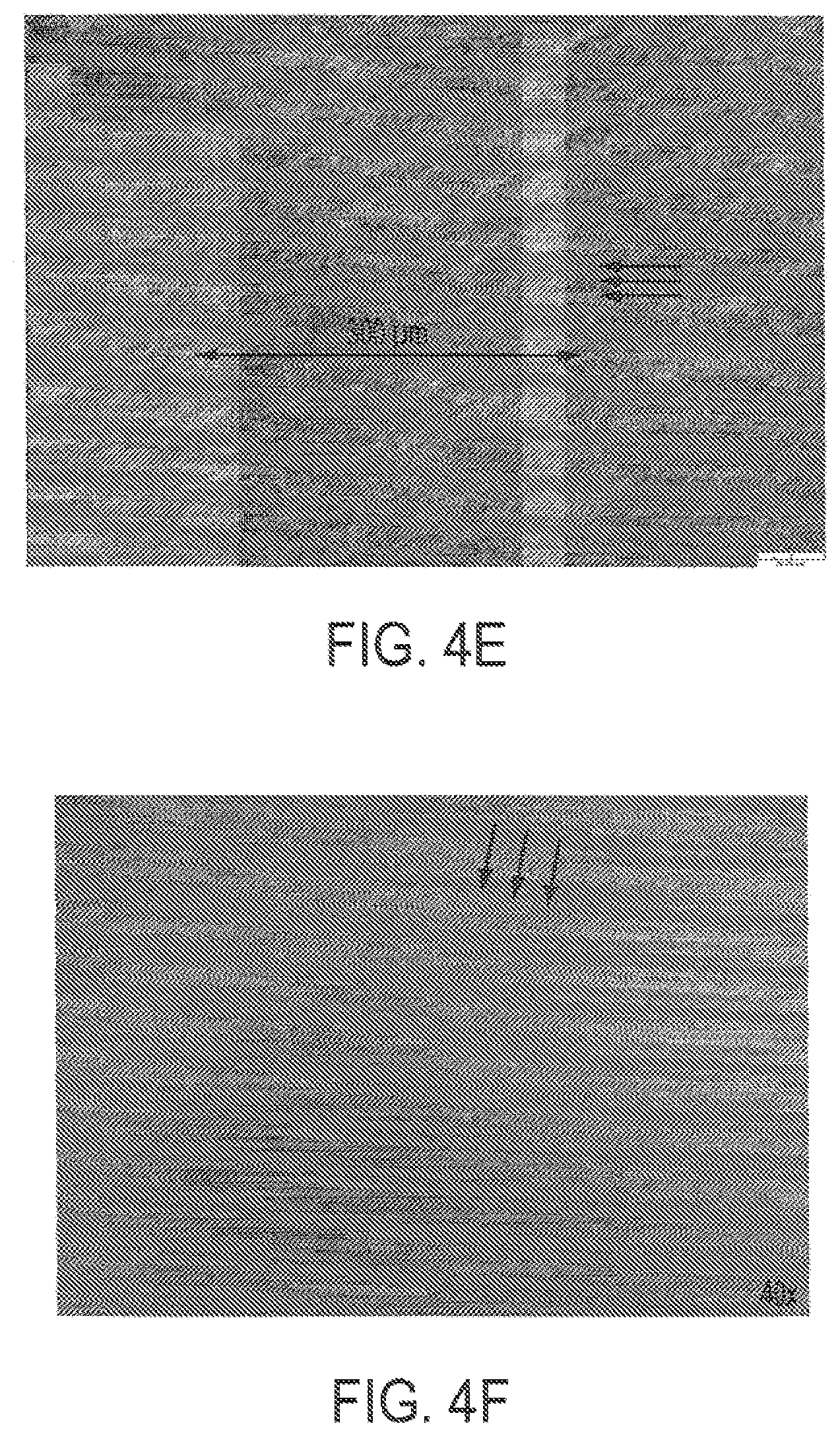 Patent US12090043 Figure 4 – Vision correction with laser refractive index changes