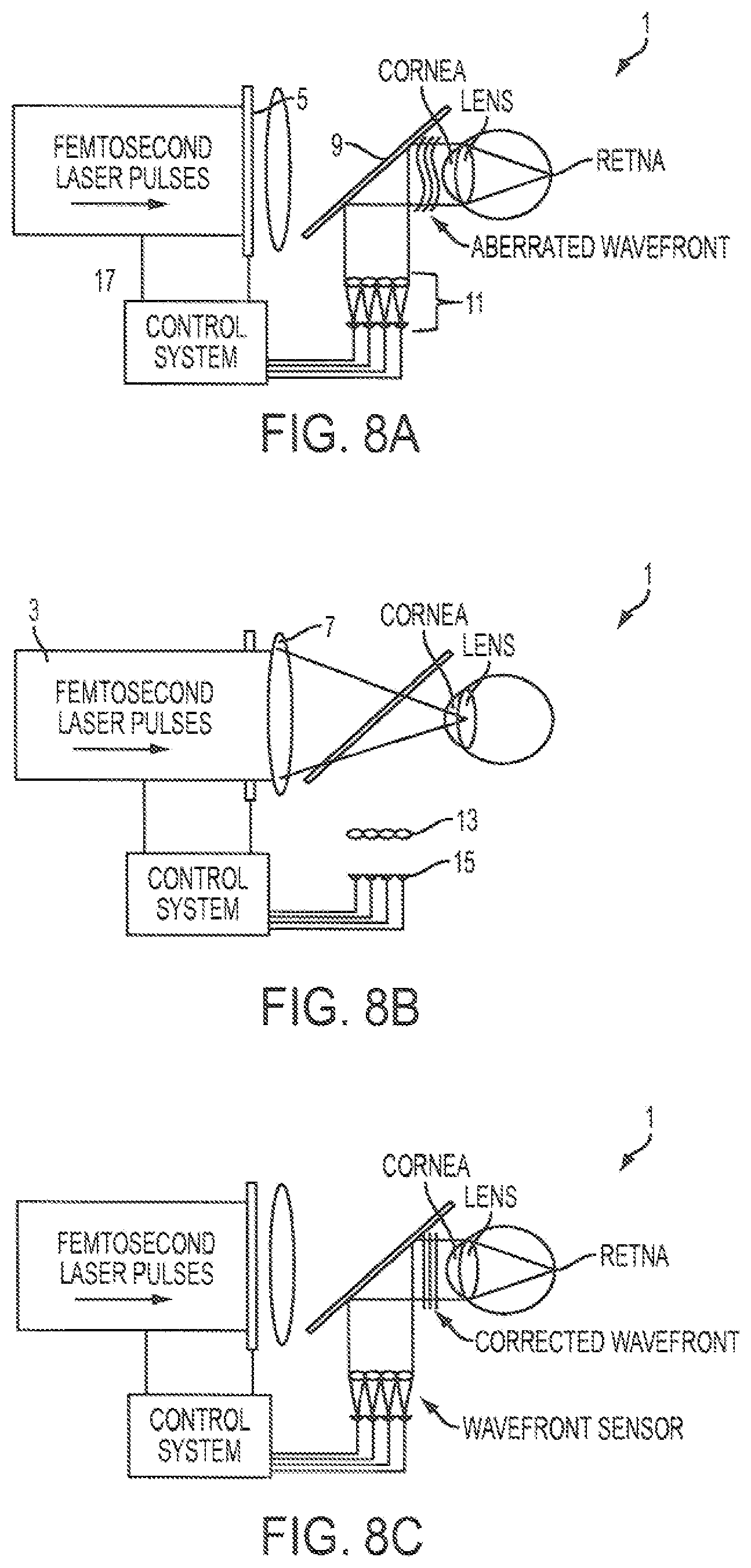 Patent US12090043 Figure 7 – Vision correction with laser refractive index changes