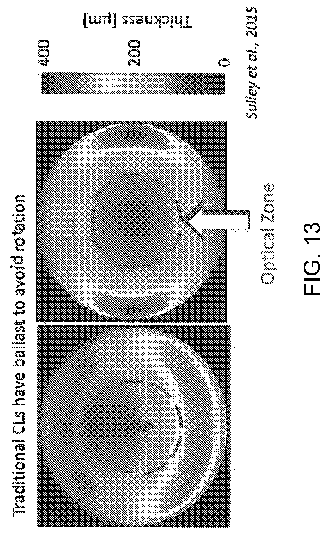 Patent US12090043 Figure 12 – Vision correction with laser refractive index changes