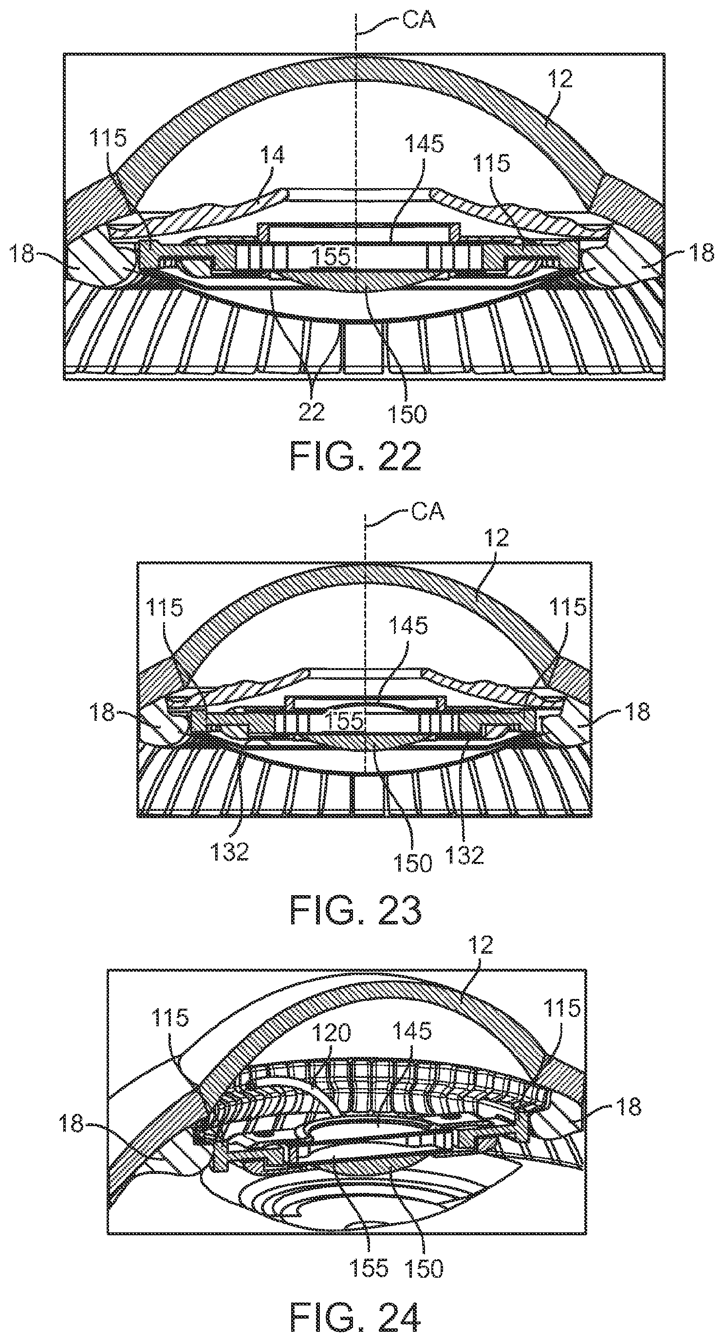 Patent US12090044 Figure 13 – Accommodating intraocular lens