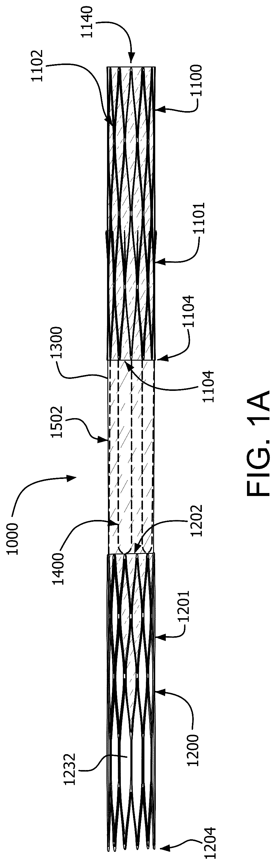 Patent US12090046 Figure 1 – Telescoping prosthetic valve with retention element