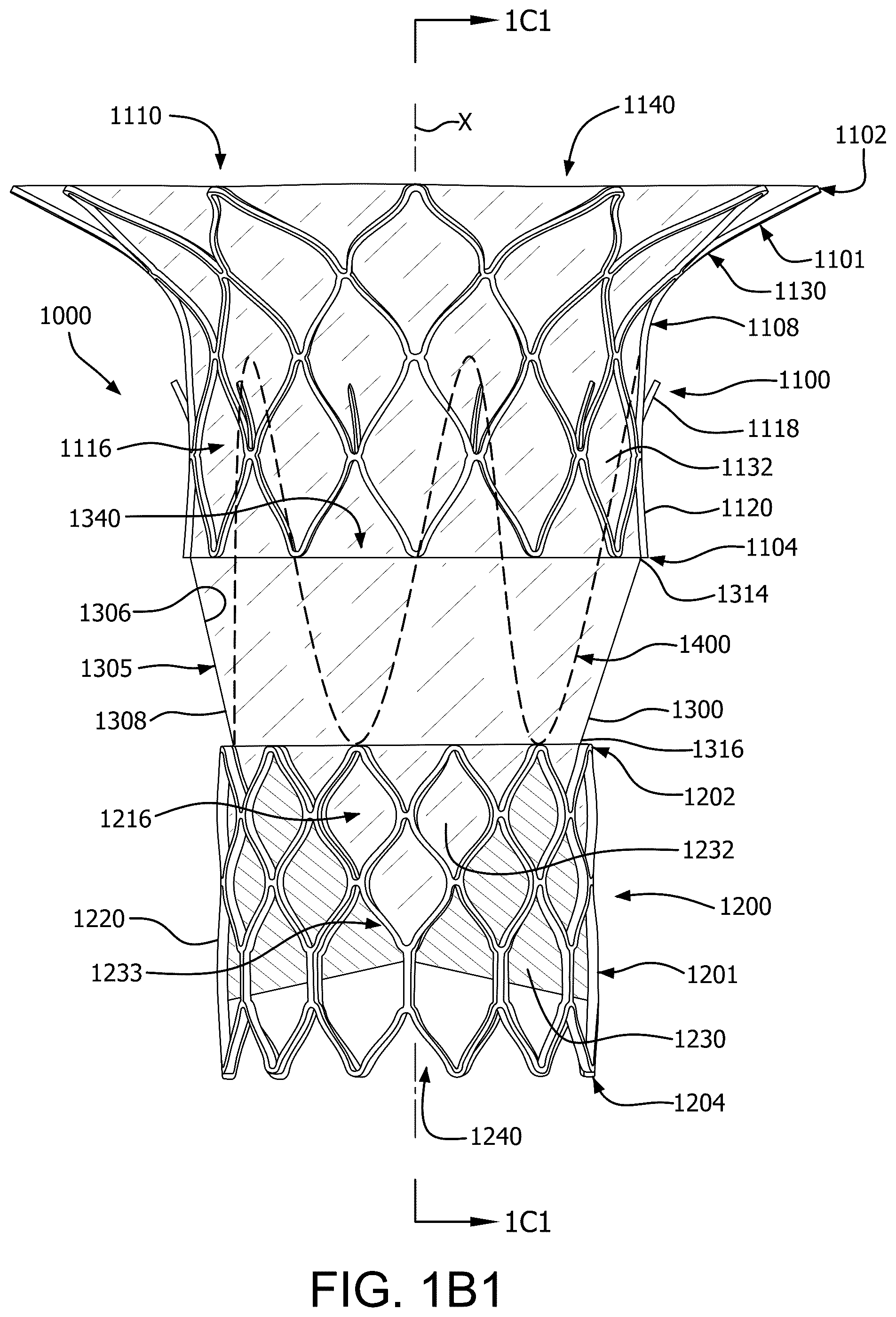 Patent US12090046 Figure 2 – Telescoping prosthetic valve with retention element