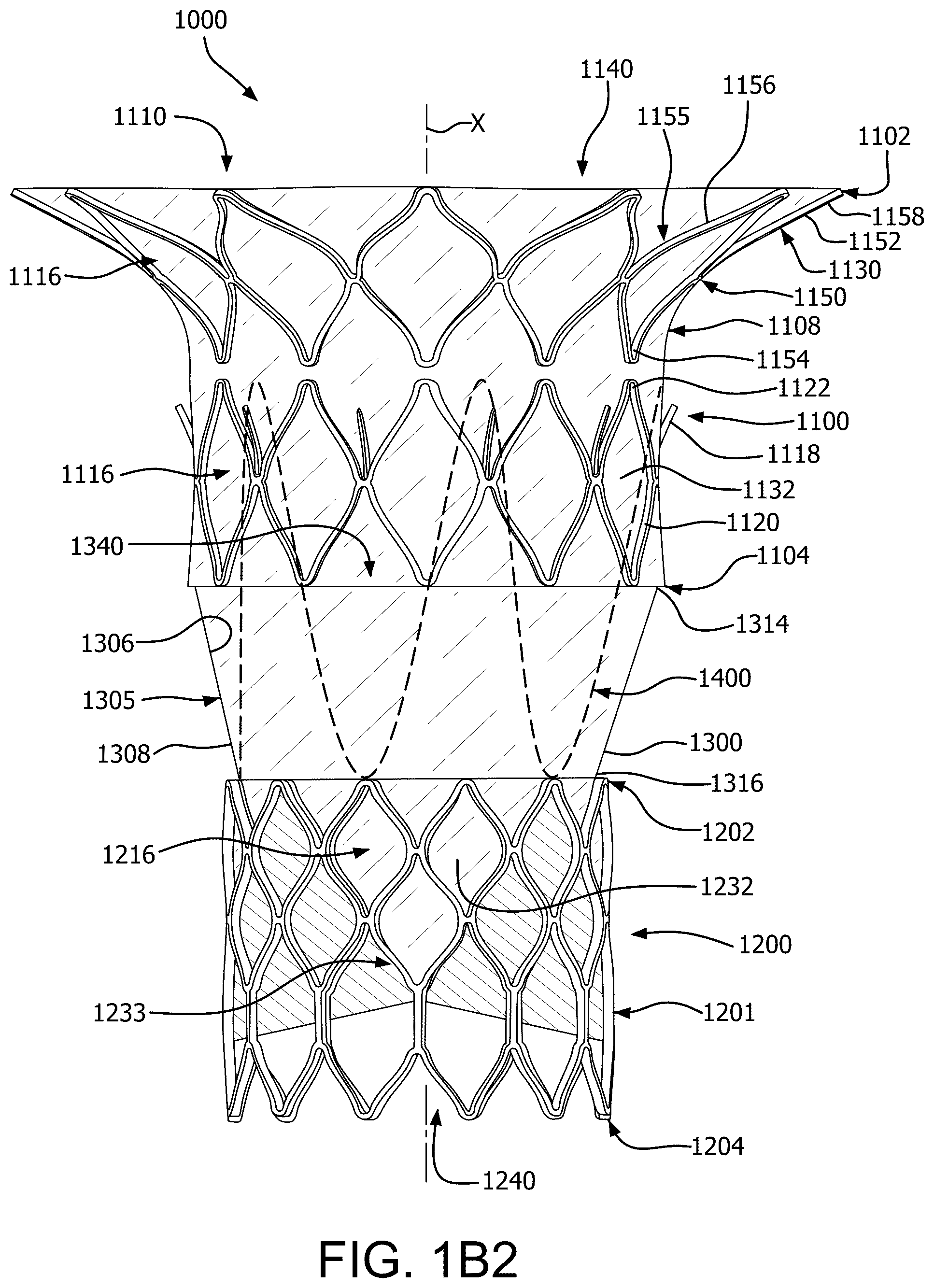 Patent US12090046 Figure 3 – Telescoping prosthetic valve with retention element