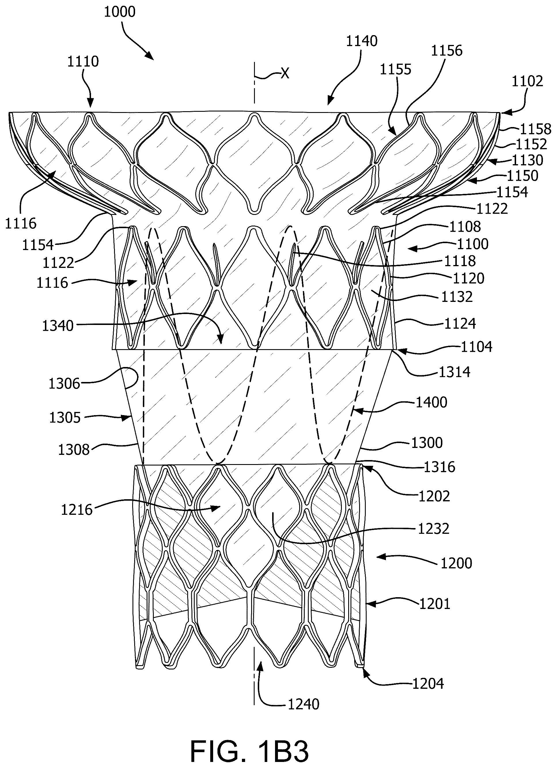 Patent US12090046 Figure 4 – Telescoping prosthetic valve with retention element