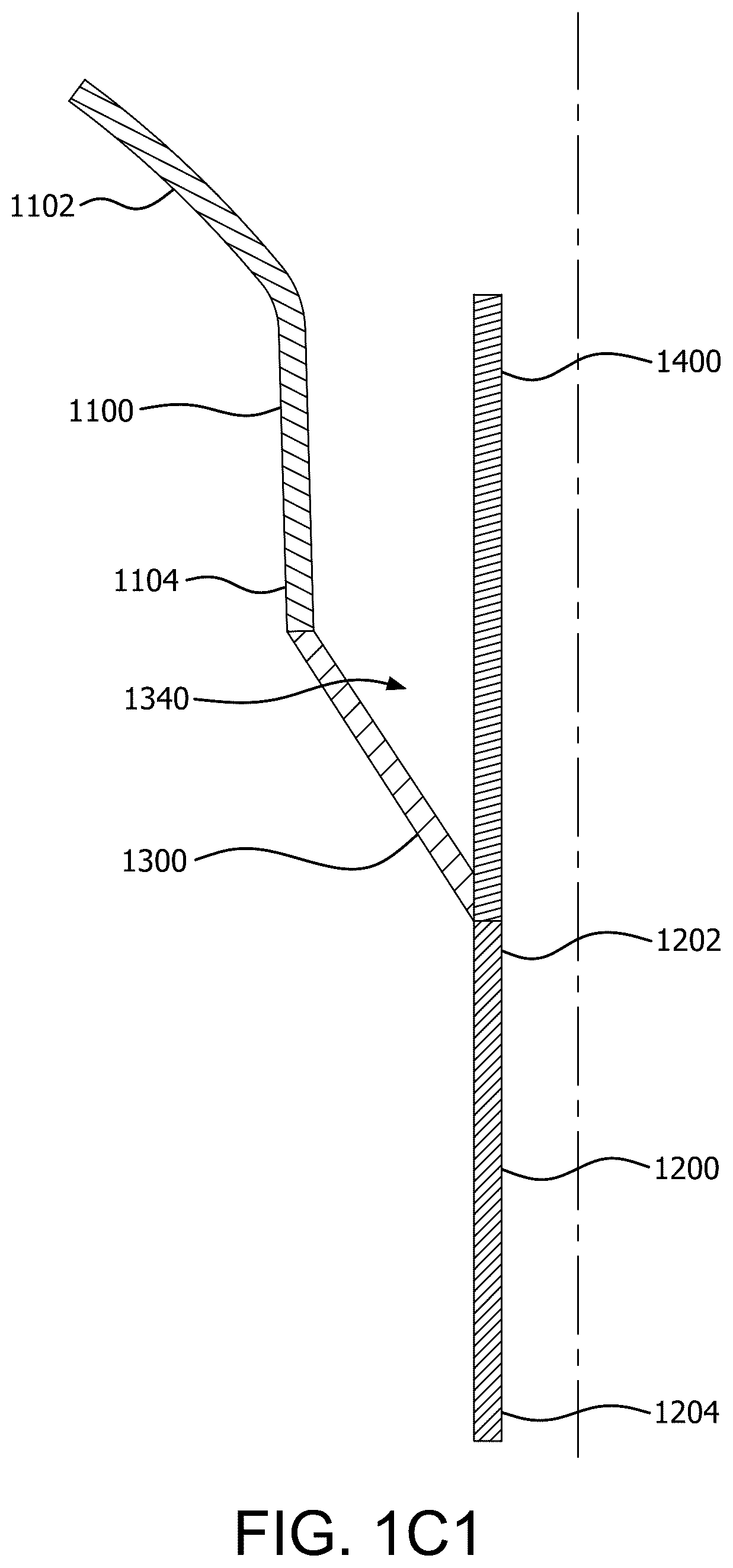 Patent US12090046 Figure 5 – Telescoping prosthetic valve with retention element