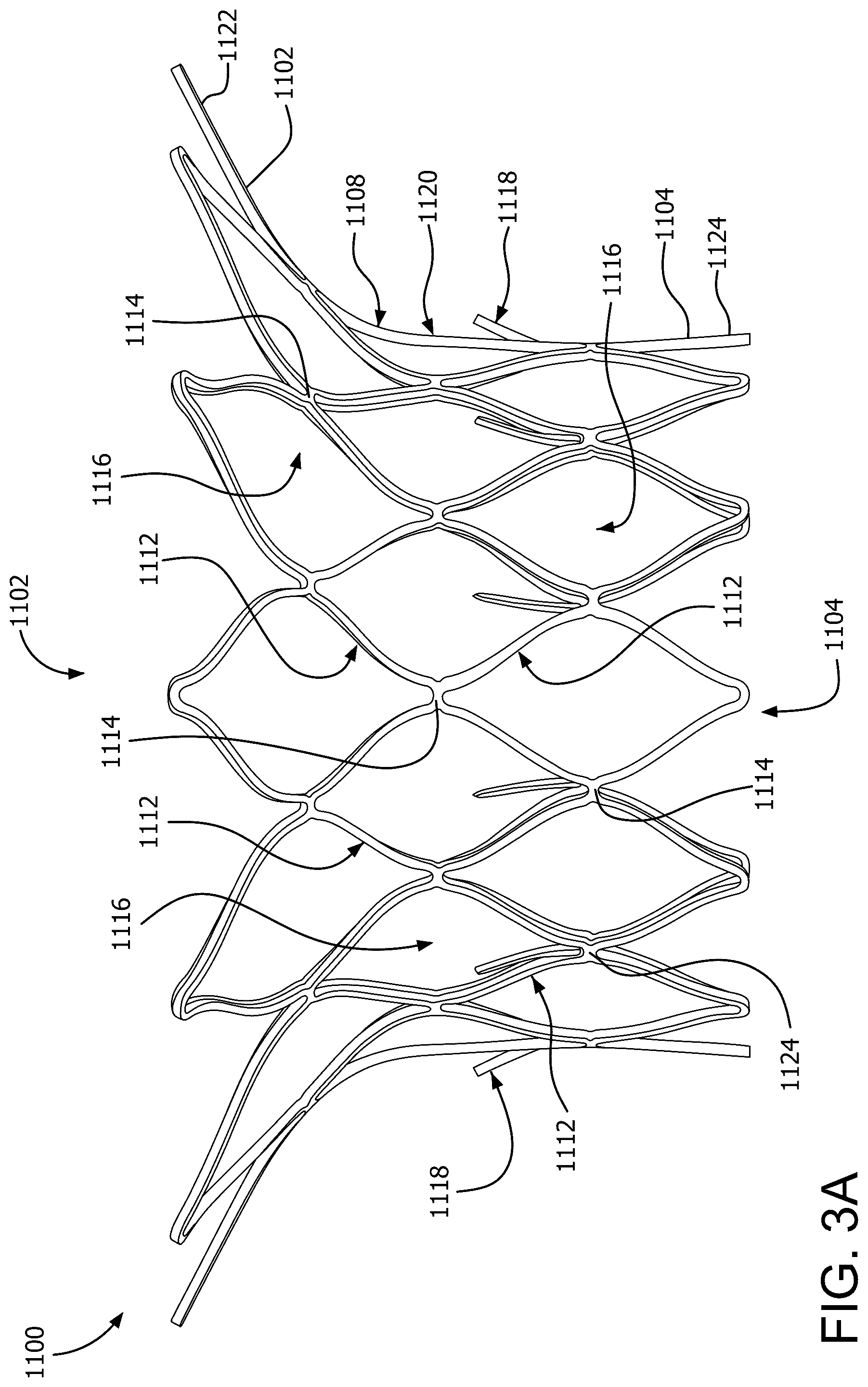 Patent US12090046 Figure 11 – Telescoping prosthetic valve with retention element