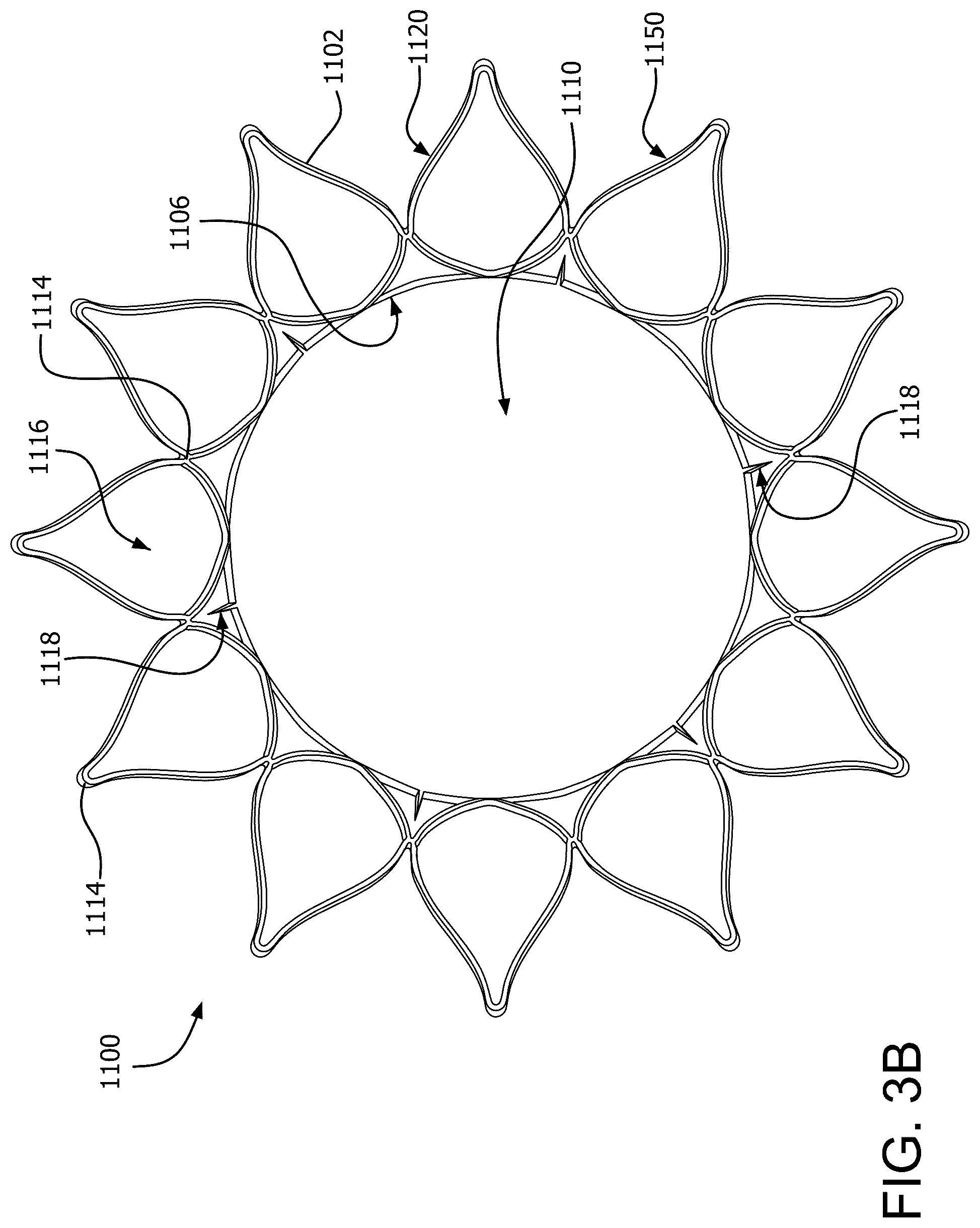 Patent US12090046 Figure 12 – Telescoping prosthetic valve with retention element