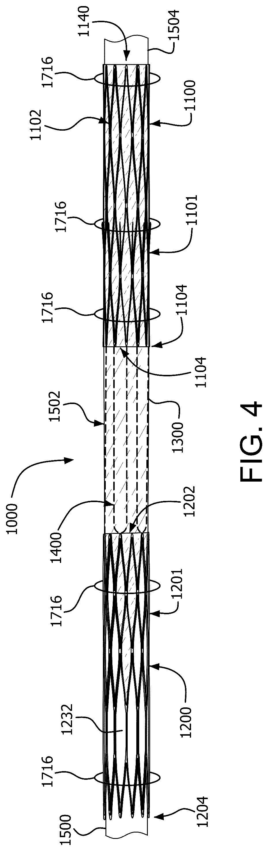 Patent US12090046 Figure 13 – Telescoping prosthetic valve with retention element