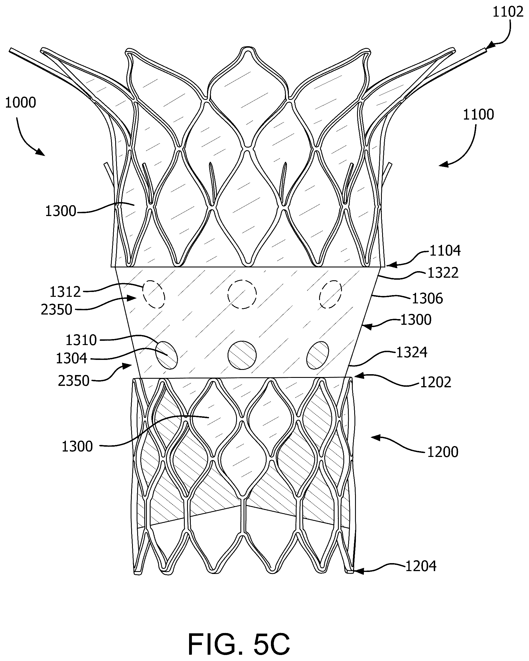 Patent US12090046 Figure 15 – Telescoping prosthetic valve with retention element