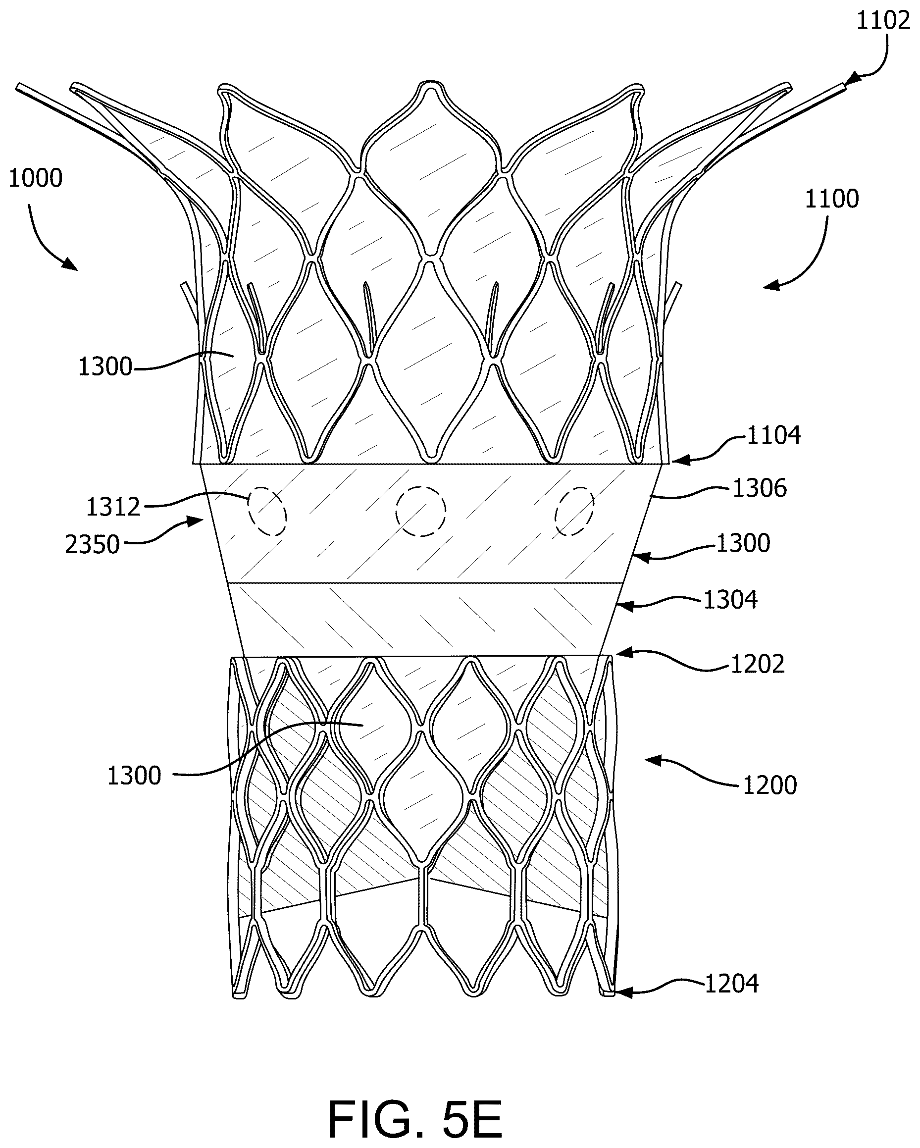 Patent US12090046 Figure 17 – Telescoping prosthetic valve with retention element