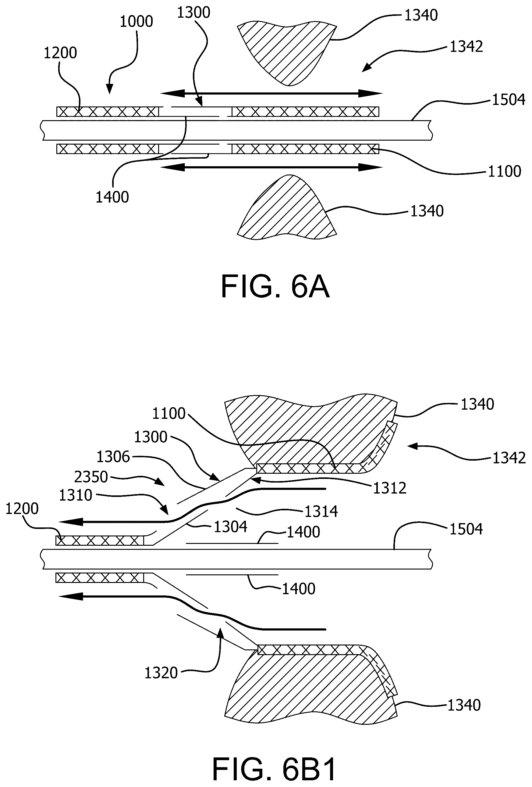 Patent US12090046 Figure 18 – Telescoping prosthetic valve with retention element