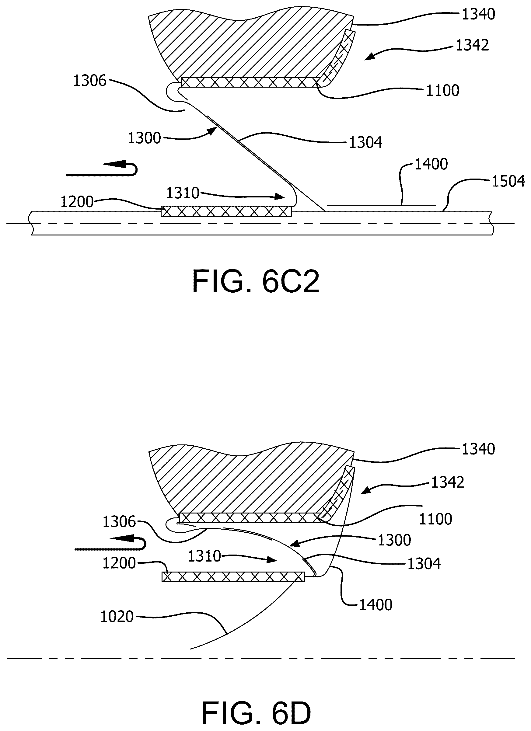 Patent US12090046 Figure 20 – Telescoping prosthetic valve with retention element